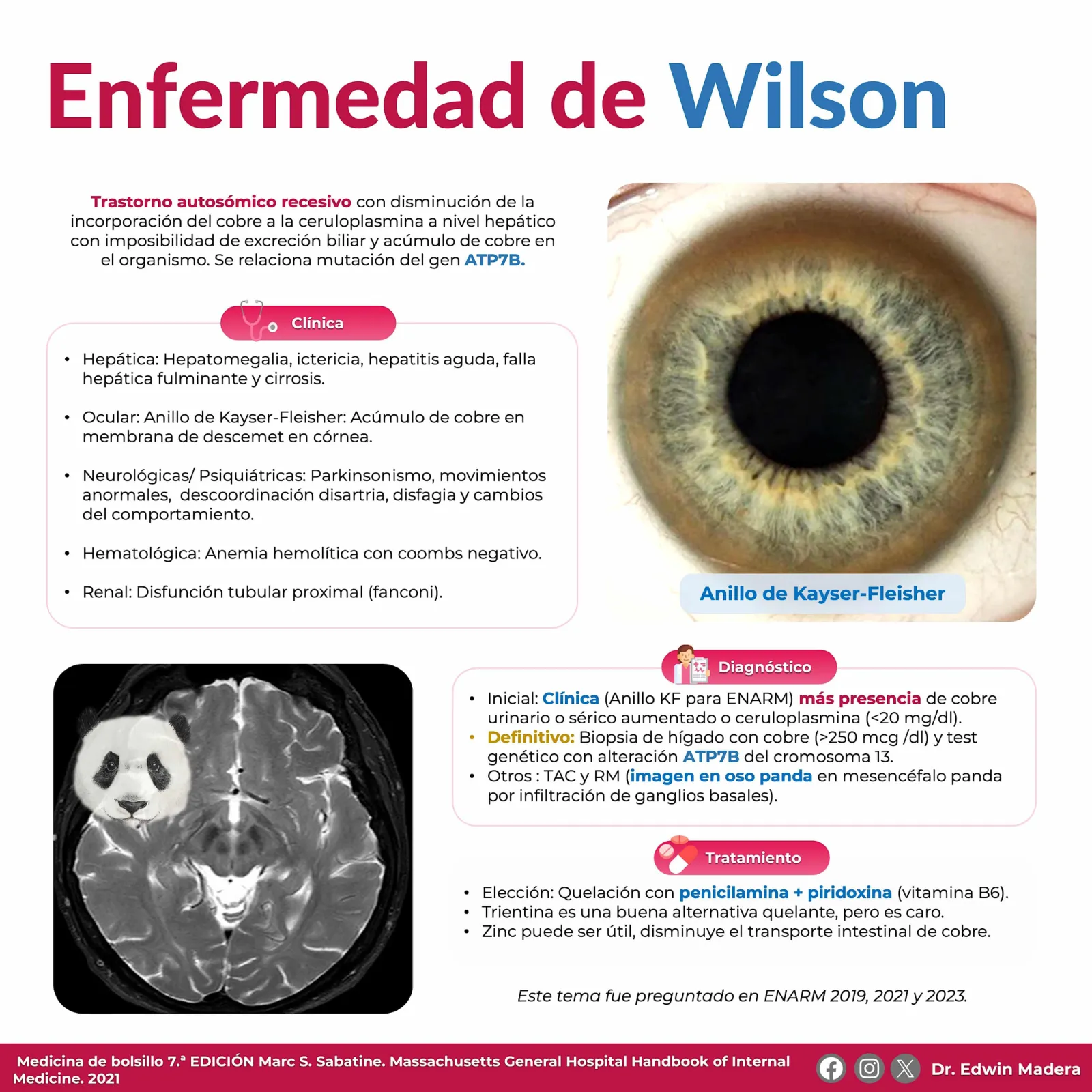 Enfermedad de Wilson