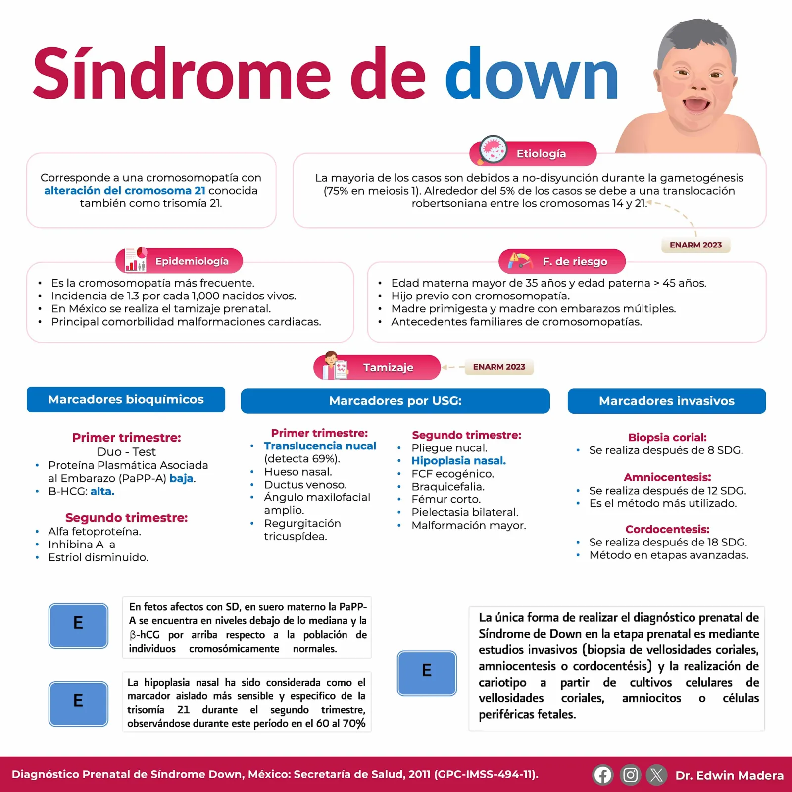 Síndrome de Down