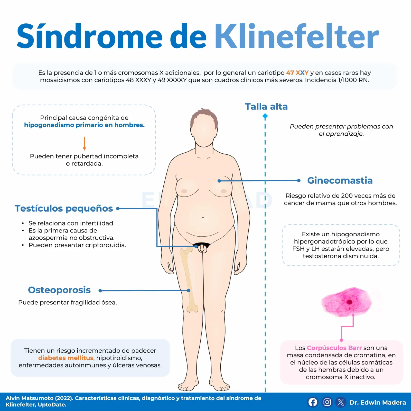 Síndrome de Klinefelter