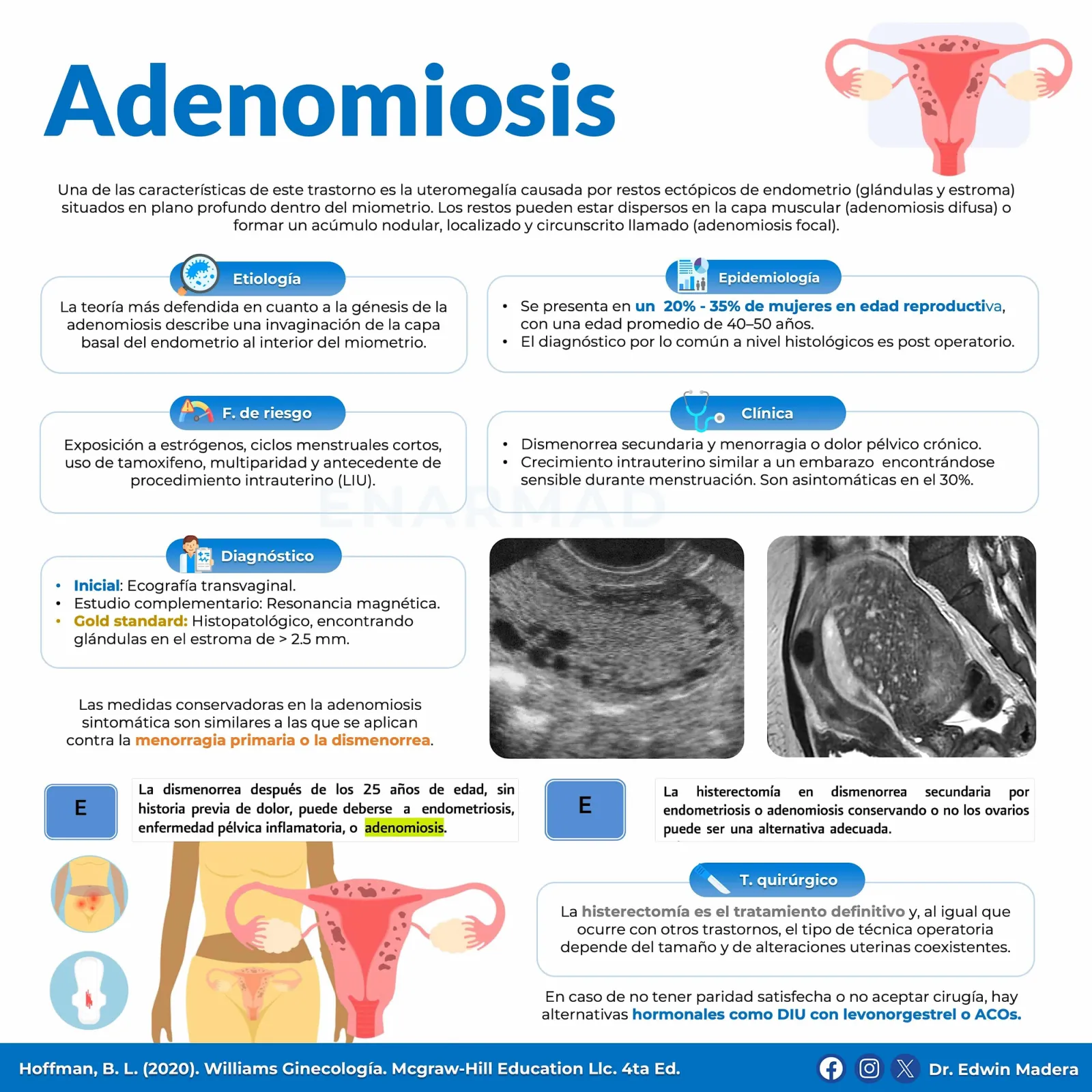 Adenomiosis