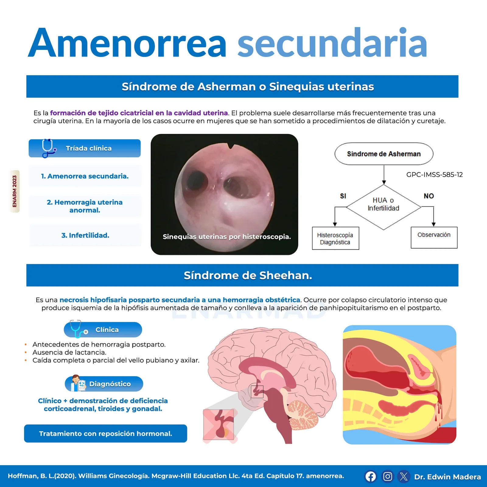 Amenorreas secundarias