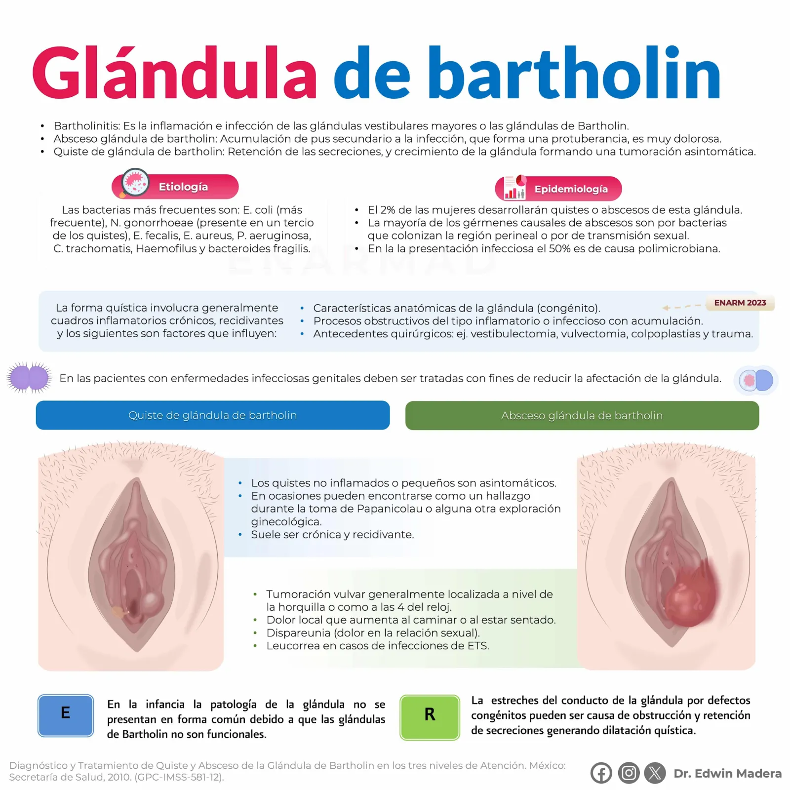 Bartolinitis