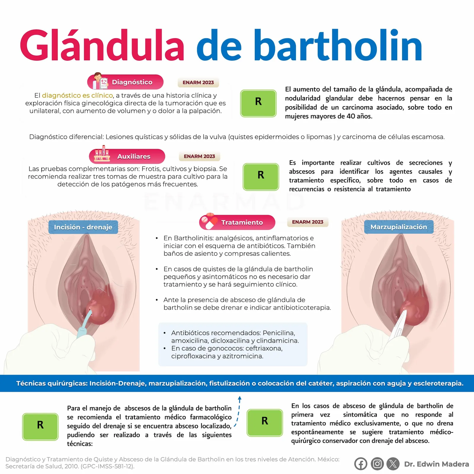Bartolinitis