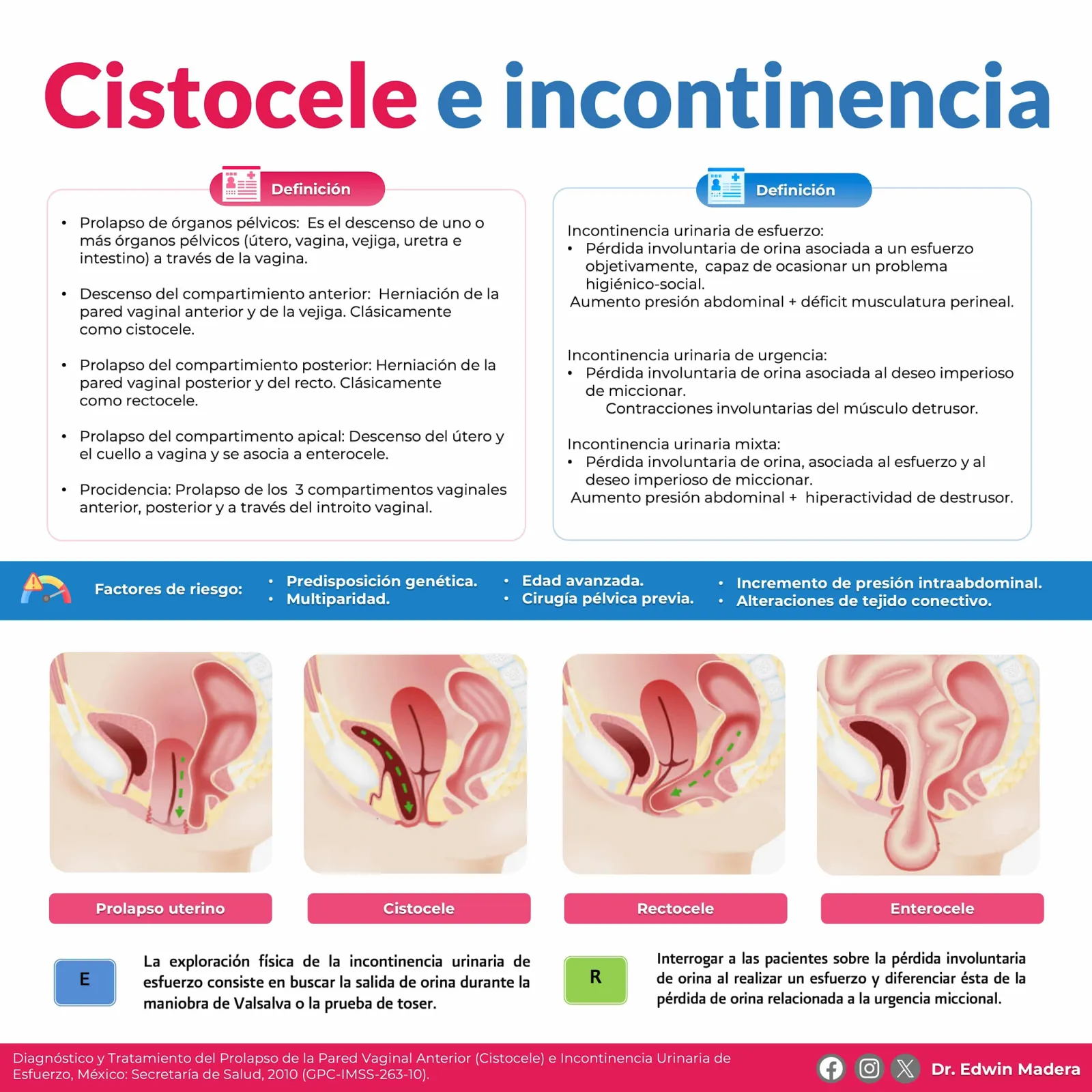 Cistocele e incontinencia