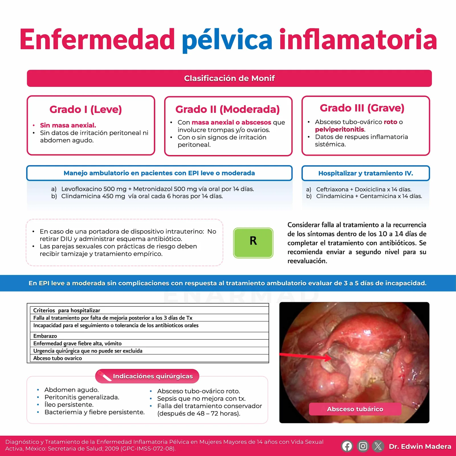 Enfermedad pélvica inflamatoria