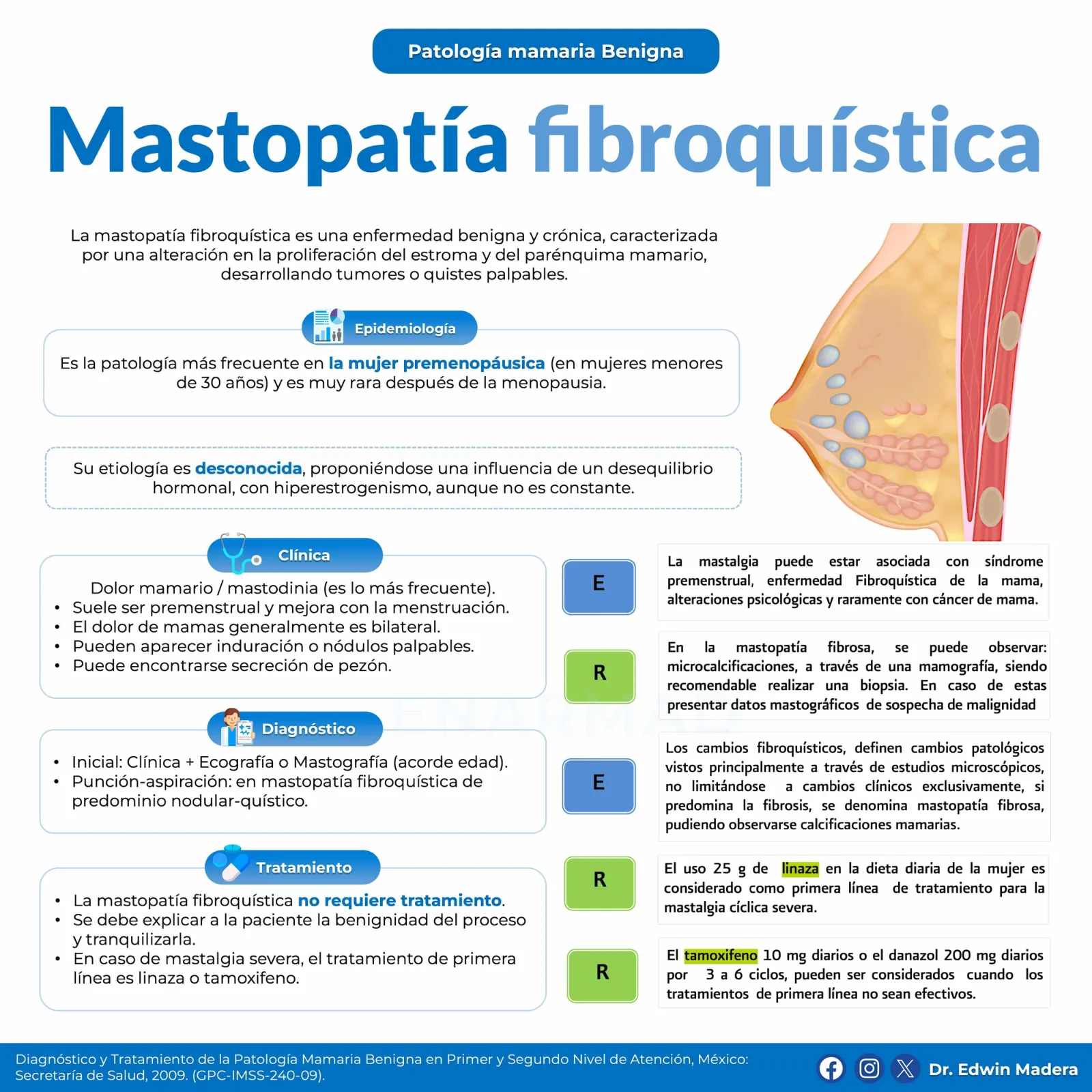 Mastopatía fibroquística