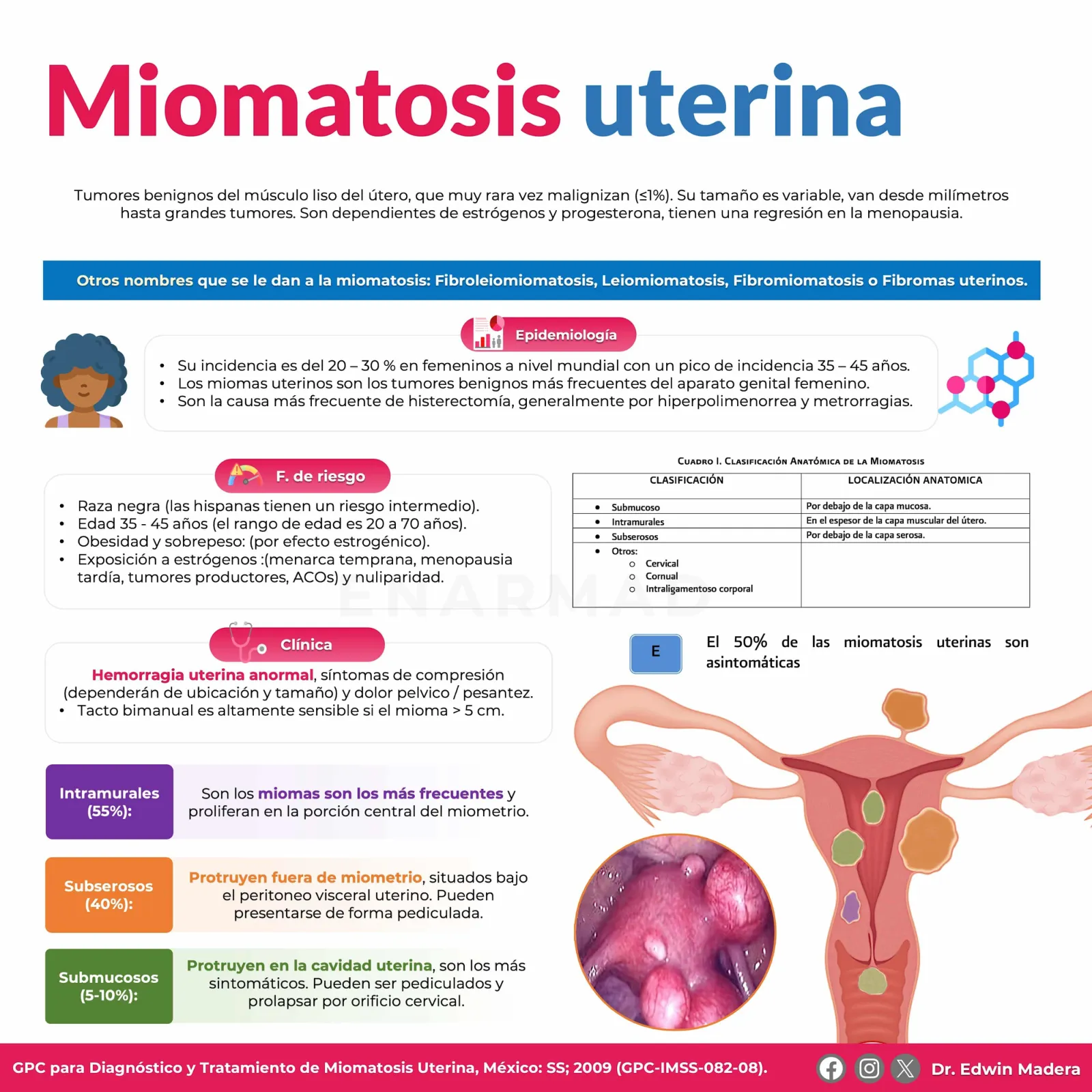 Miomatosis uterina