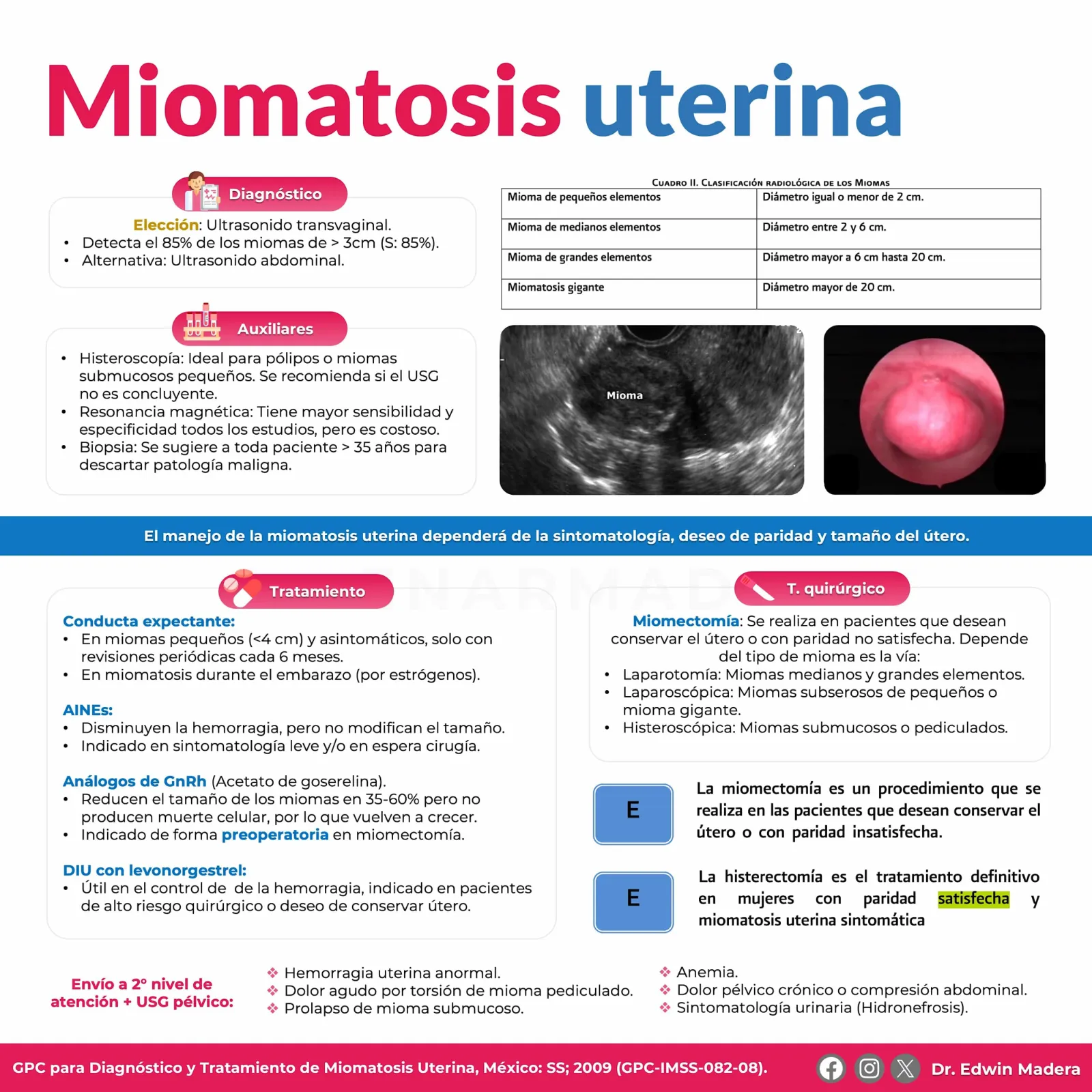 Miomatosis uterina
