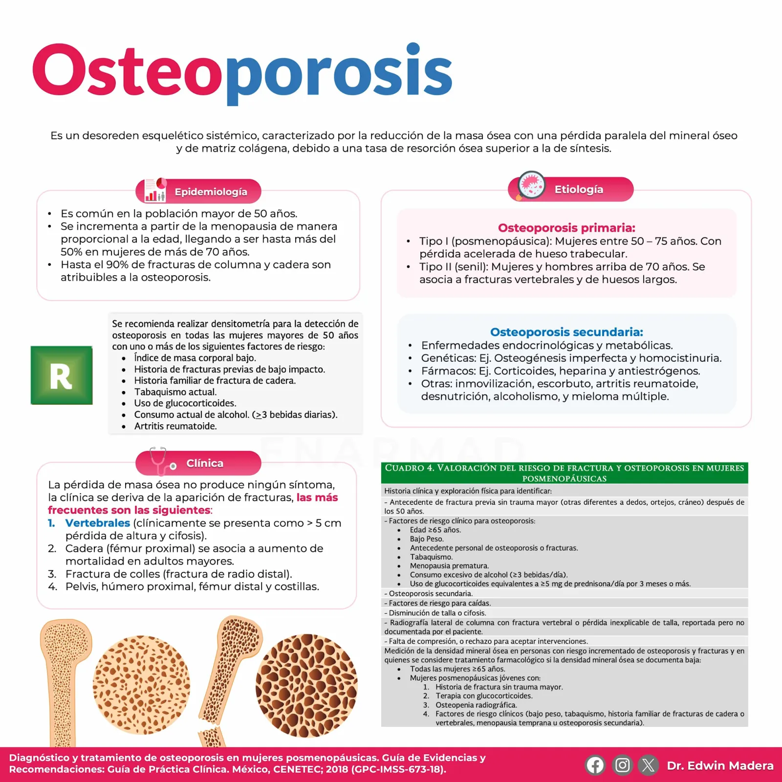 Osteoporosis post menopausia
