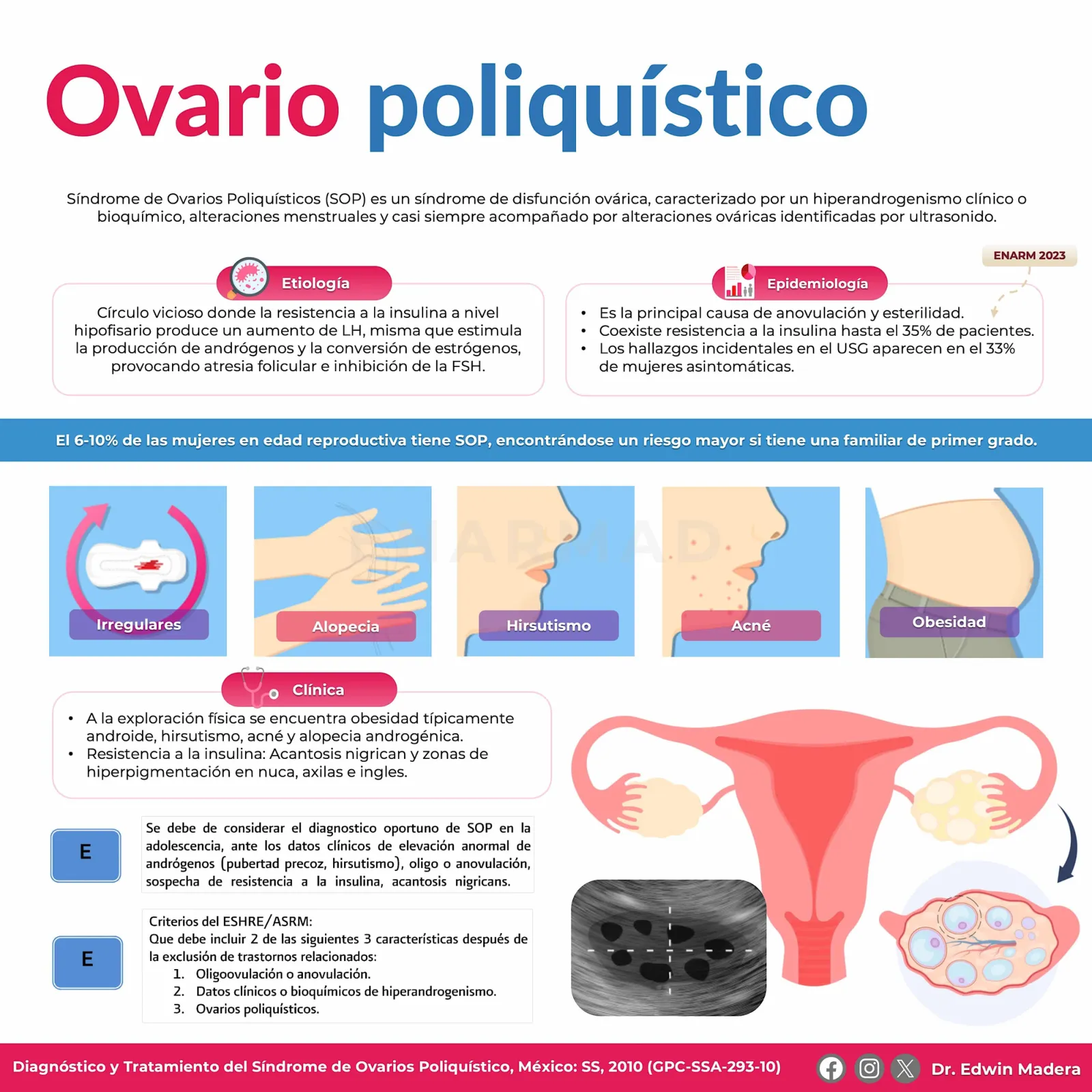 Ovario poliquístico