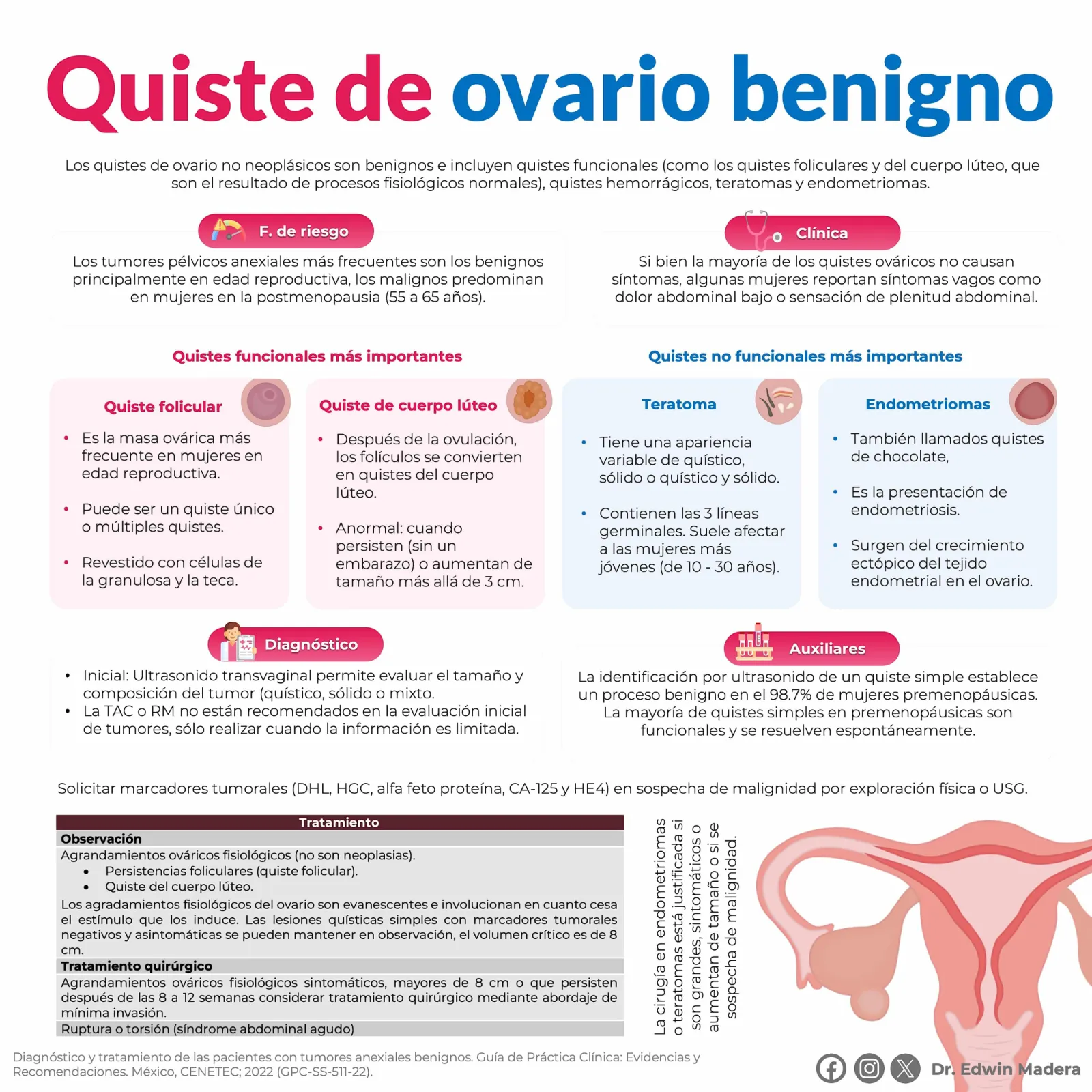 Quiste de ovario benigno