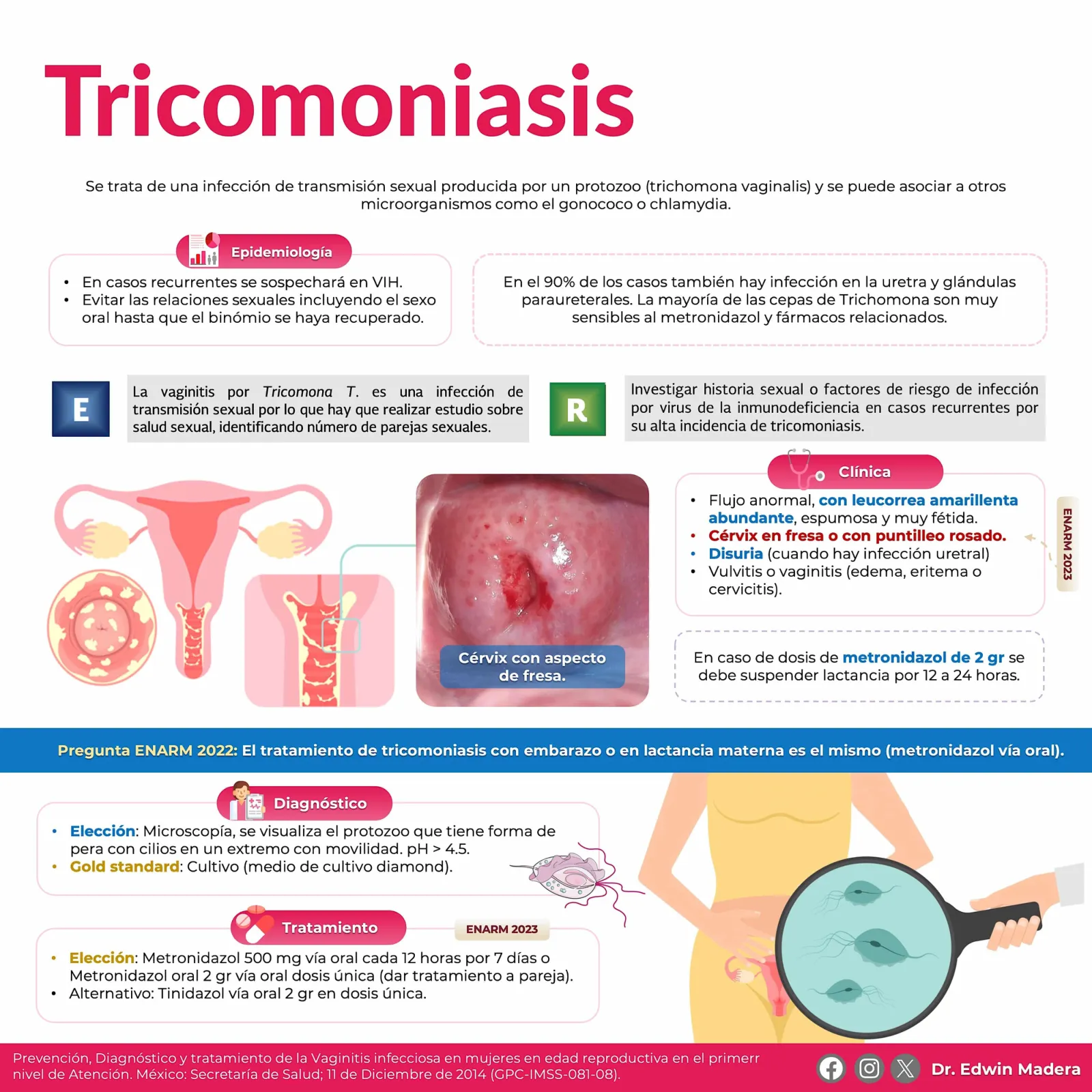 Trichomoniasis