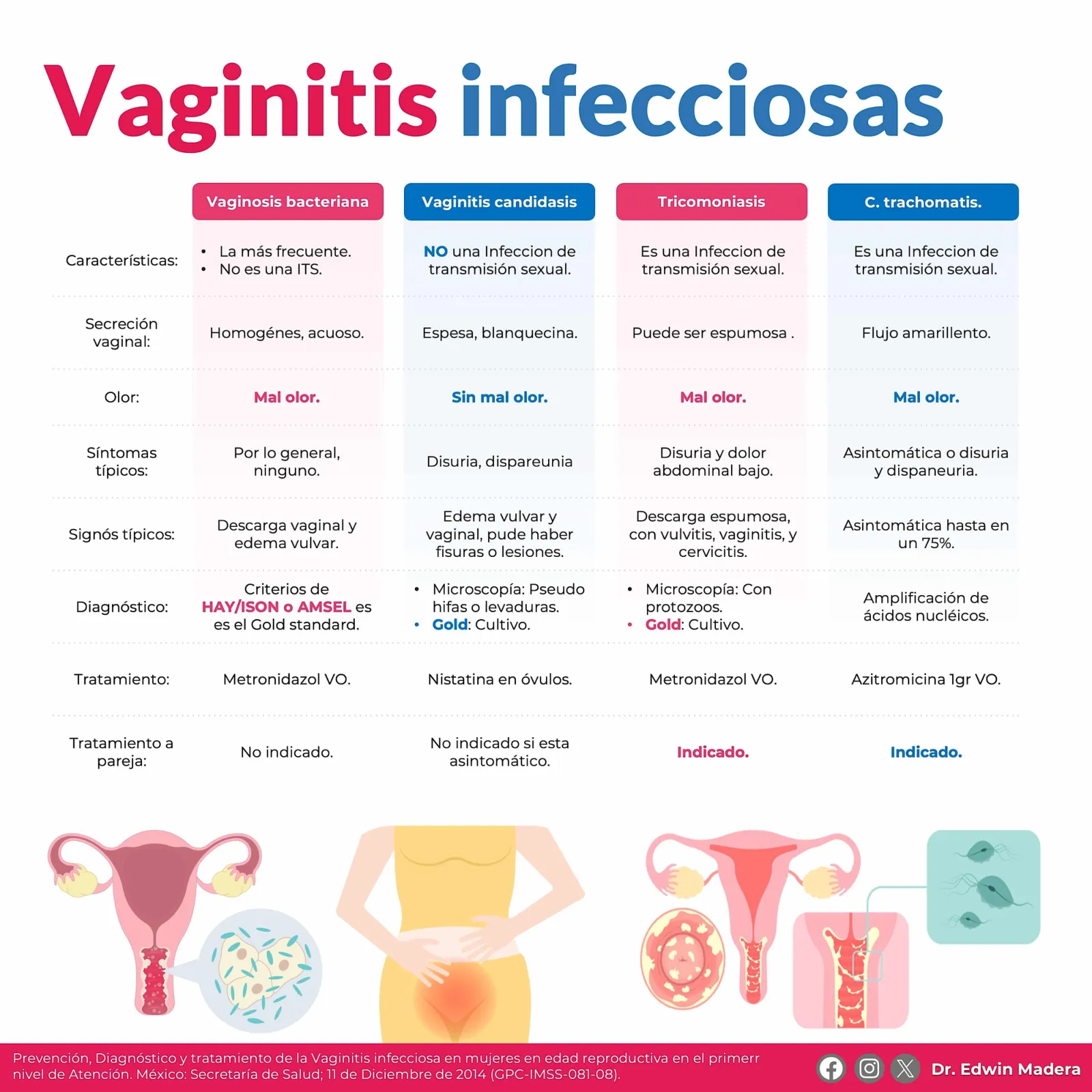 Vaginitis infeccionsa