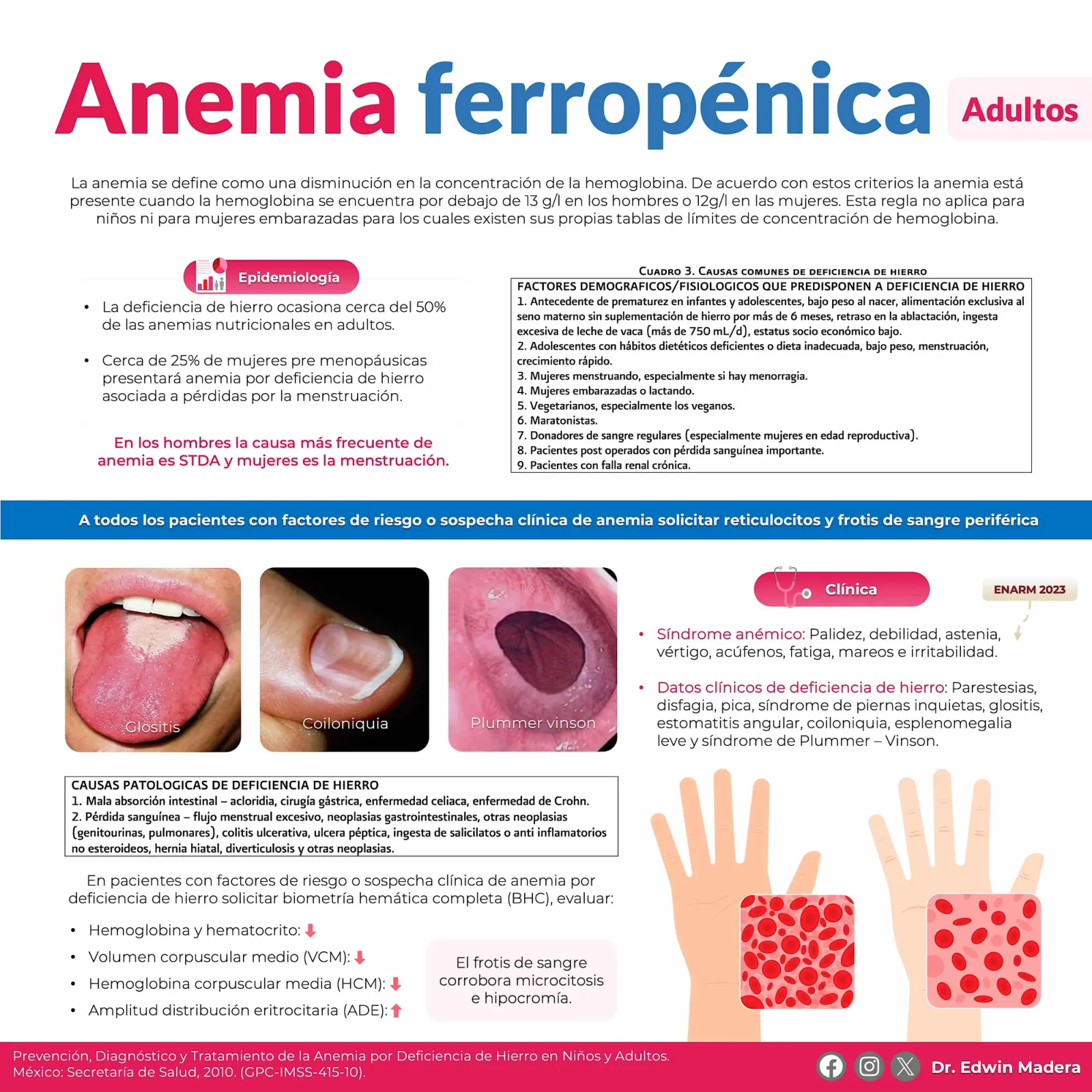 Anemia ferropénica Adultos