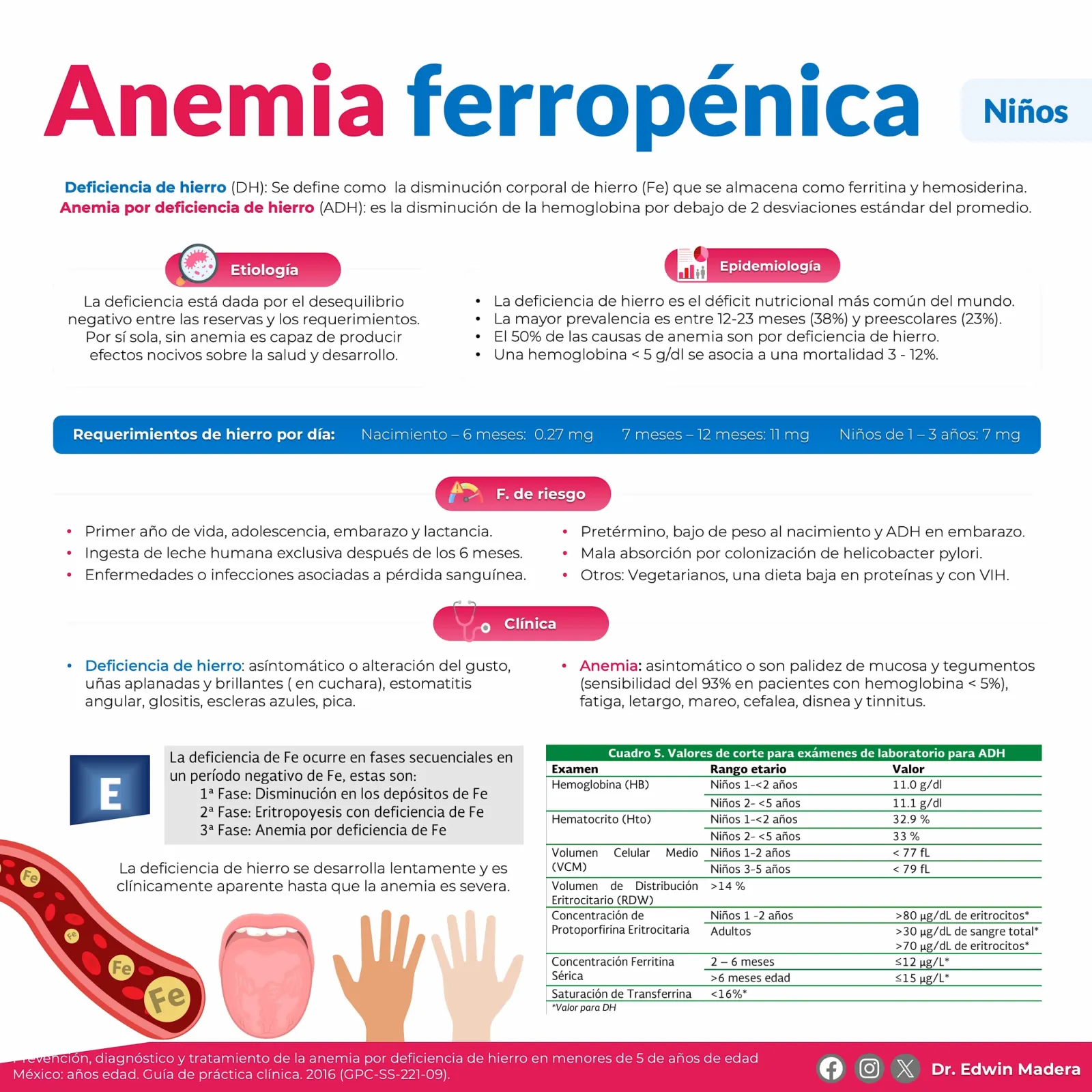 Anemia ferropénica Niños