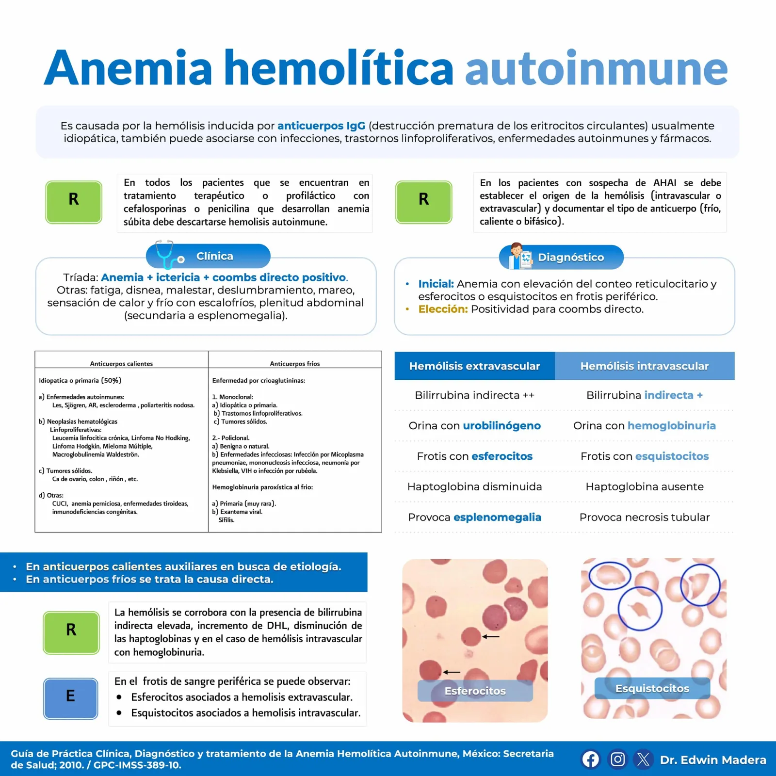 Anemia hemolítica autoinmune