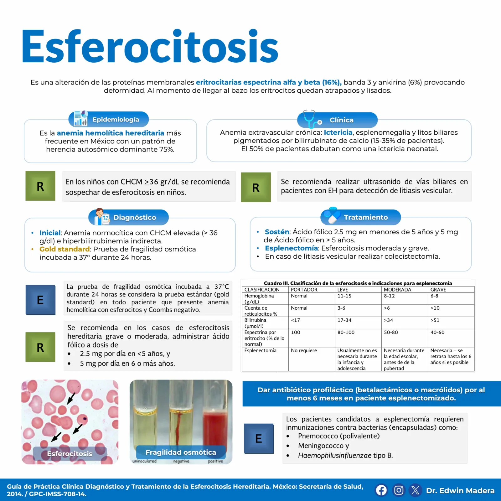 Esferocitosis