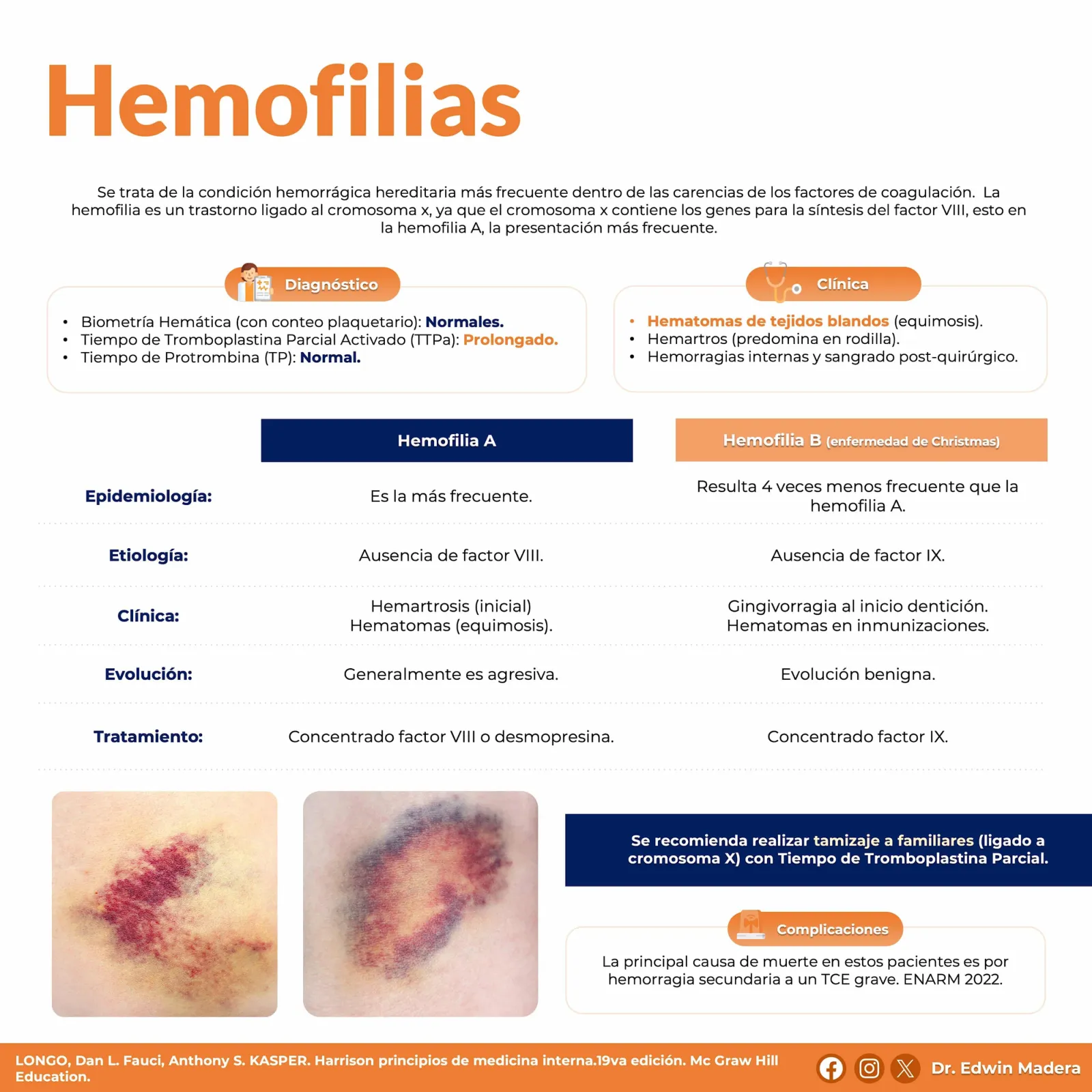 Hemofilias
