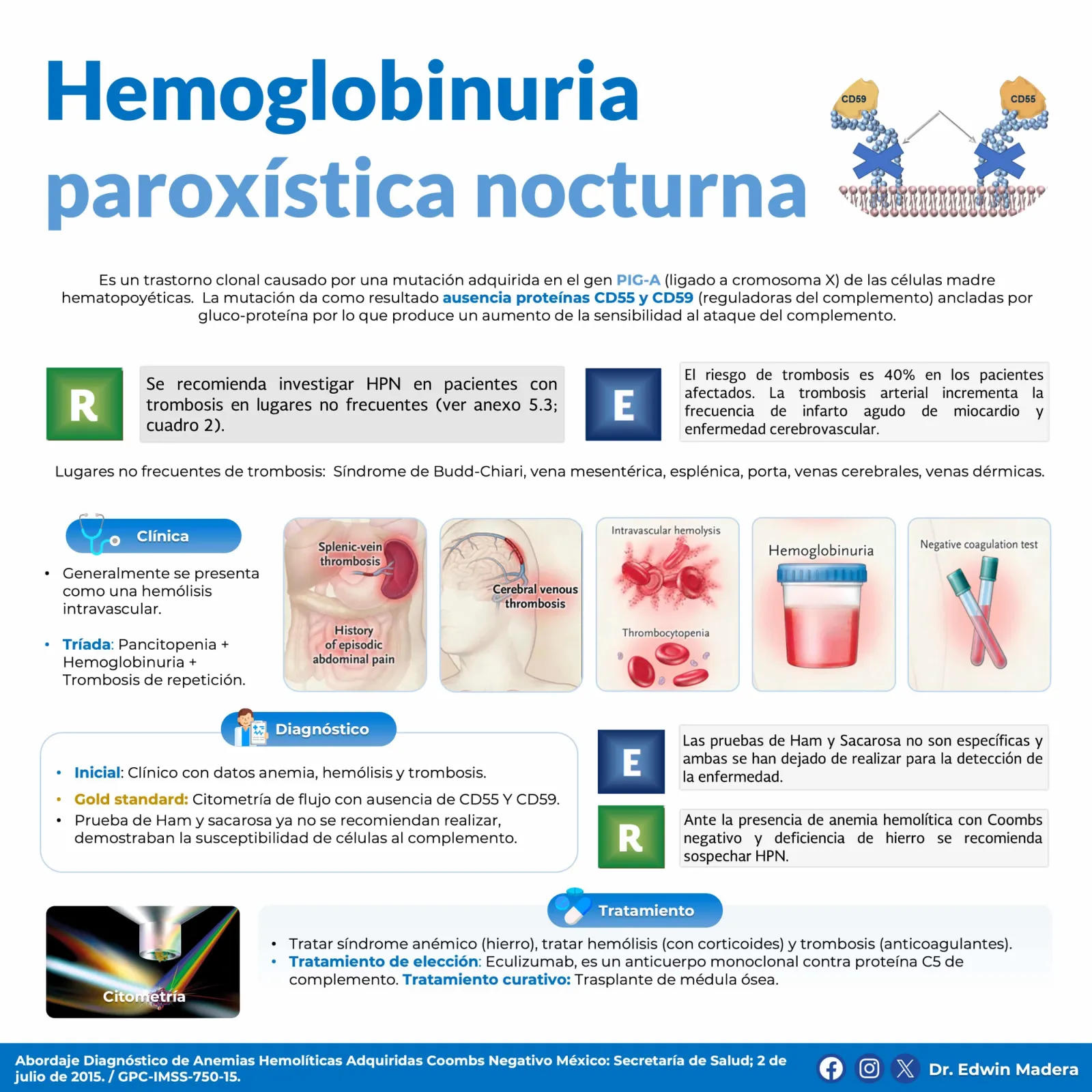 Hemoglobinuria paroxística nocturna