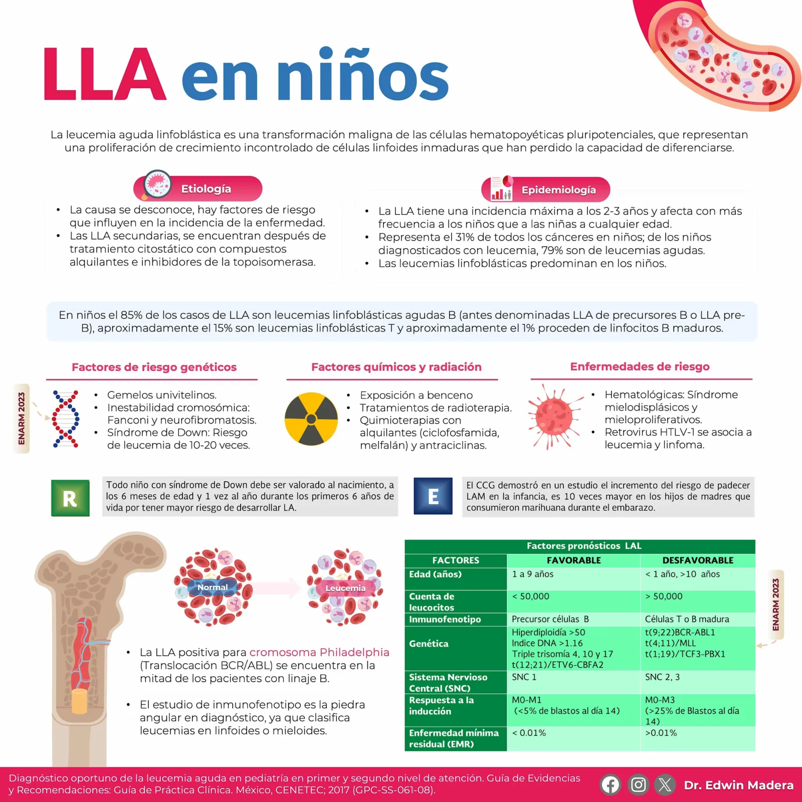 Leucemia linfoblástica aguda