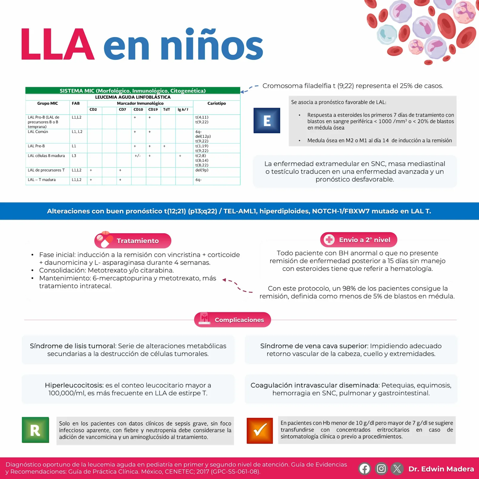 Leucemia linfoblástica aguda