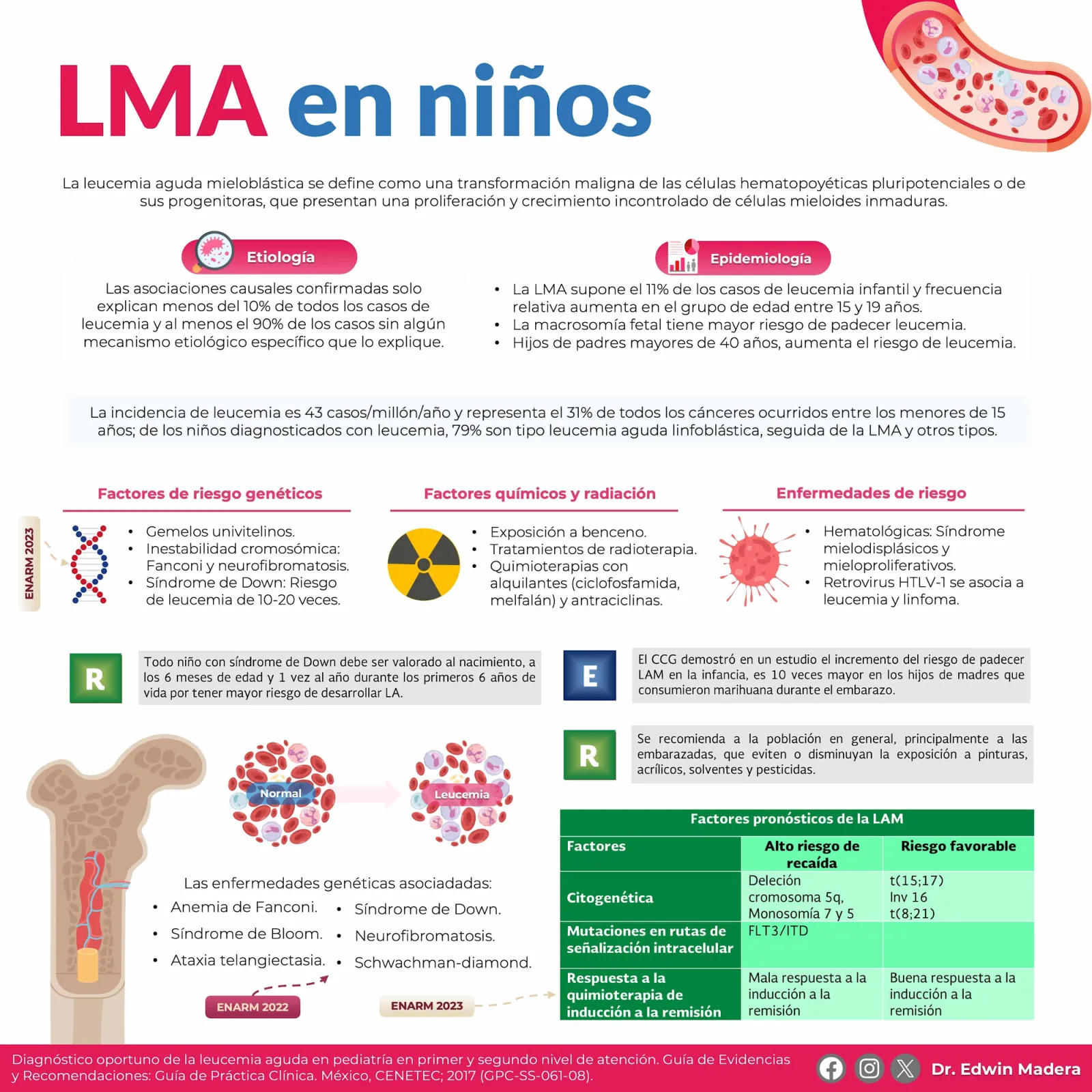 Leucemia mieloblástica aguda