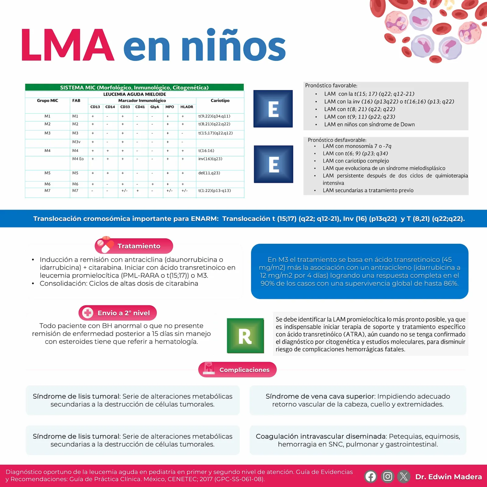 Leucemia mieloblástica aguda