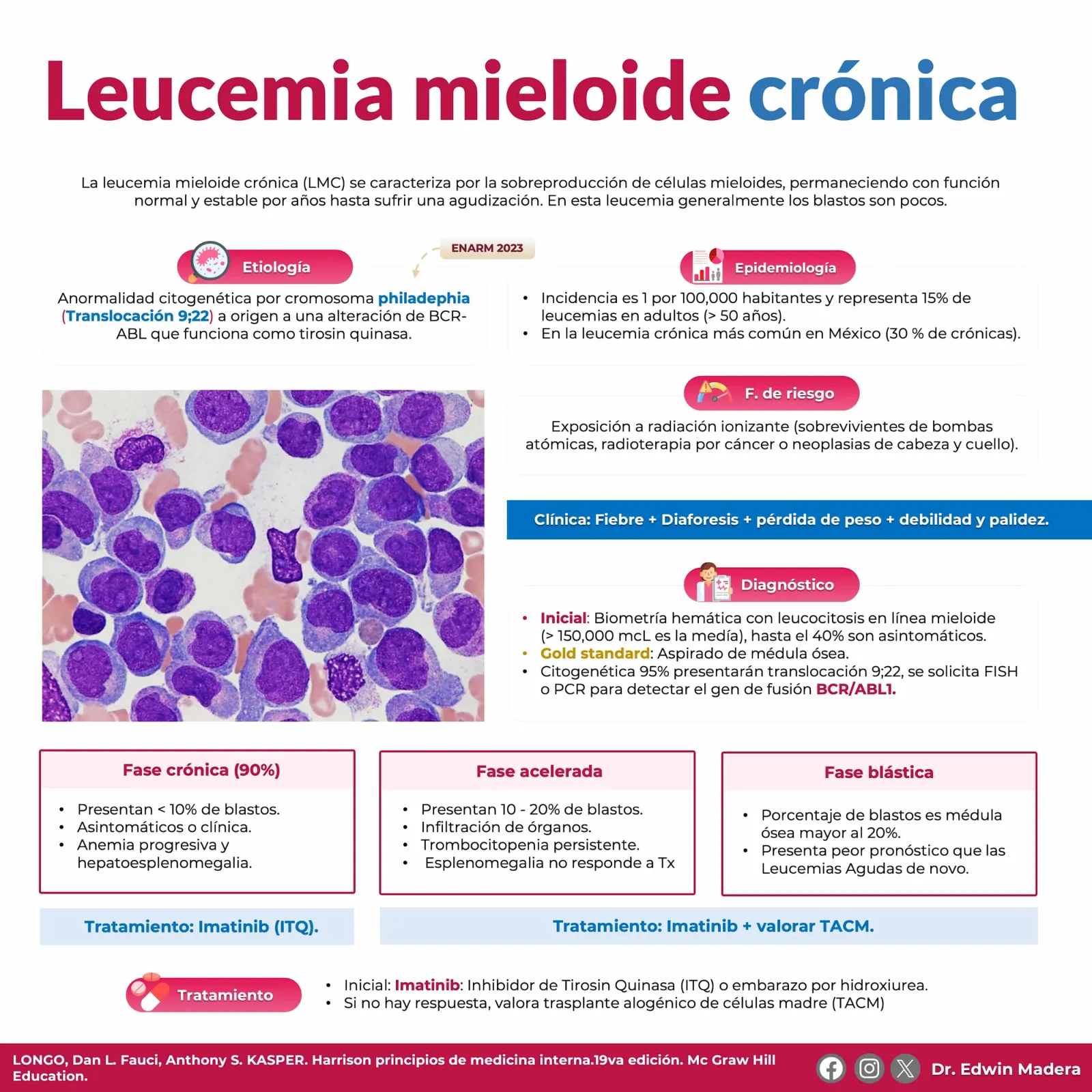 Leucemia mieloide crónica