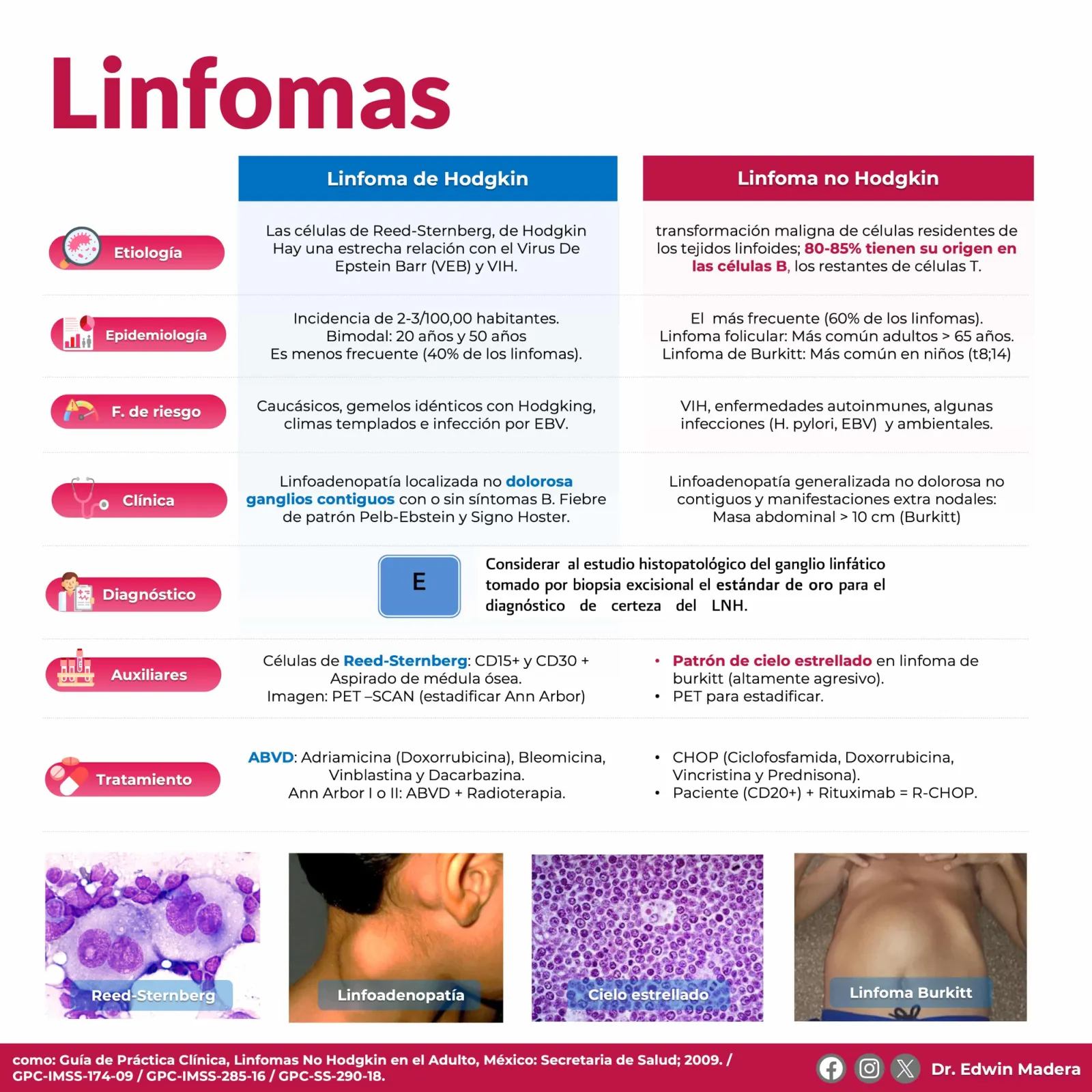 Linfoma no Hodgkin