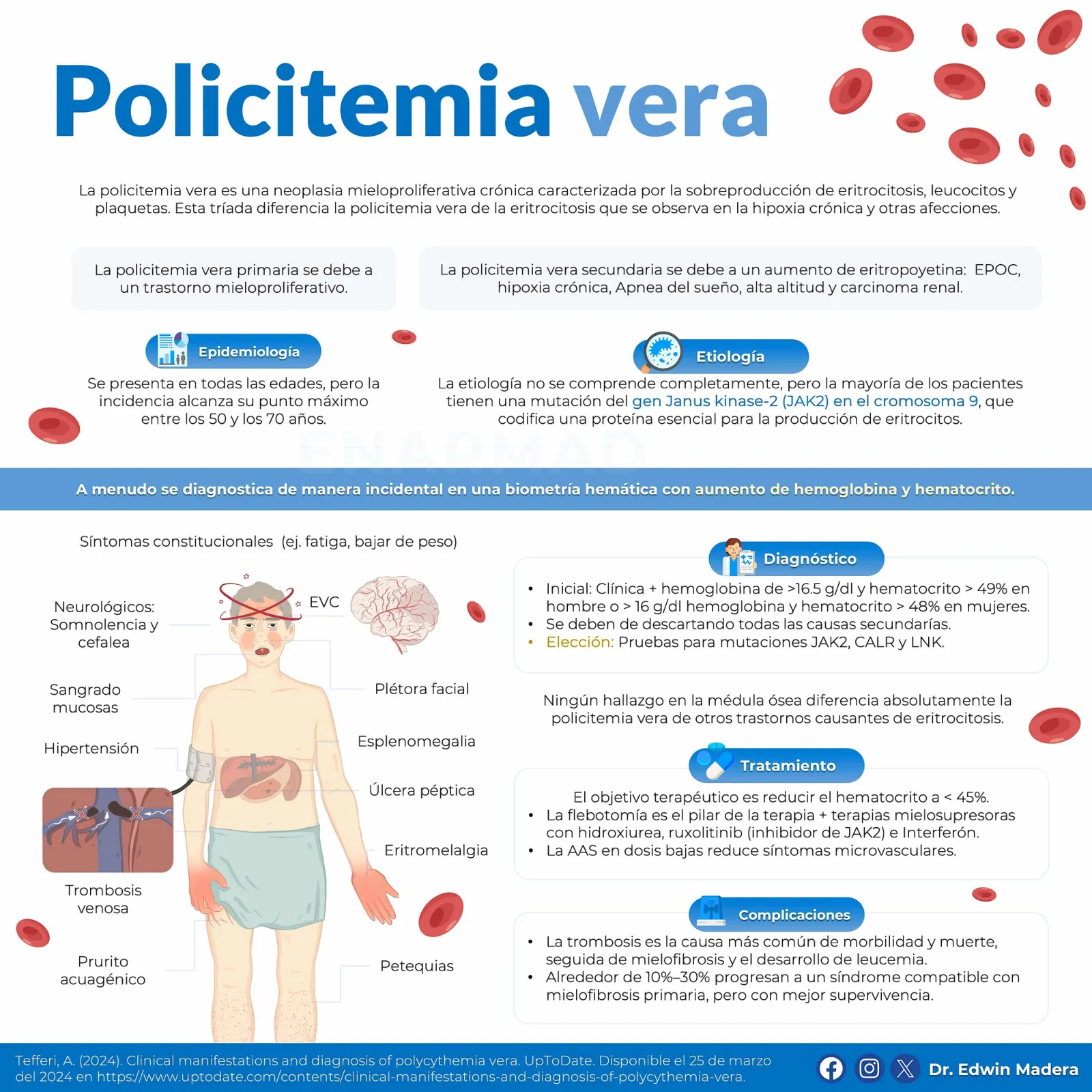 Policitemia vera