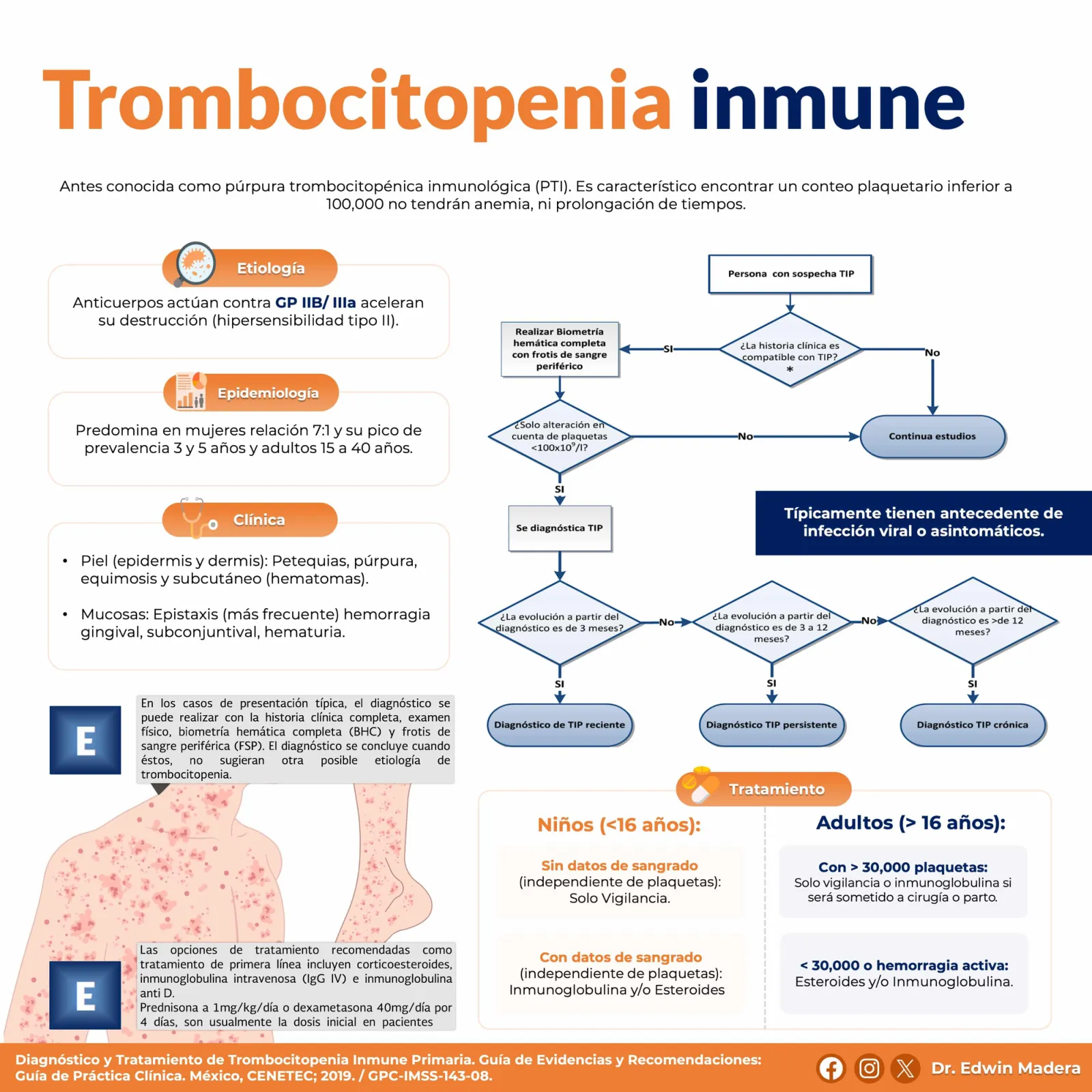 Trombocitopenia inmune