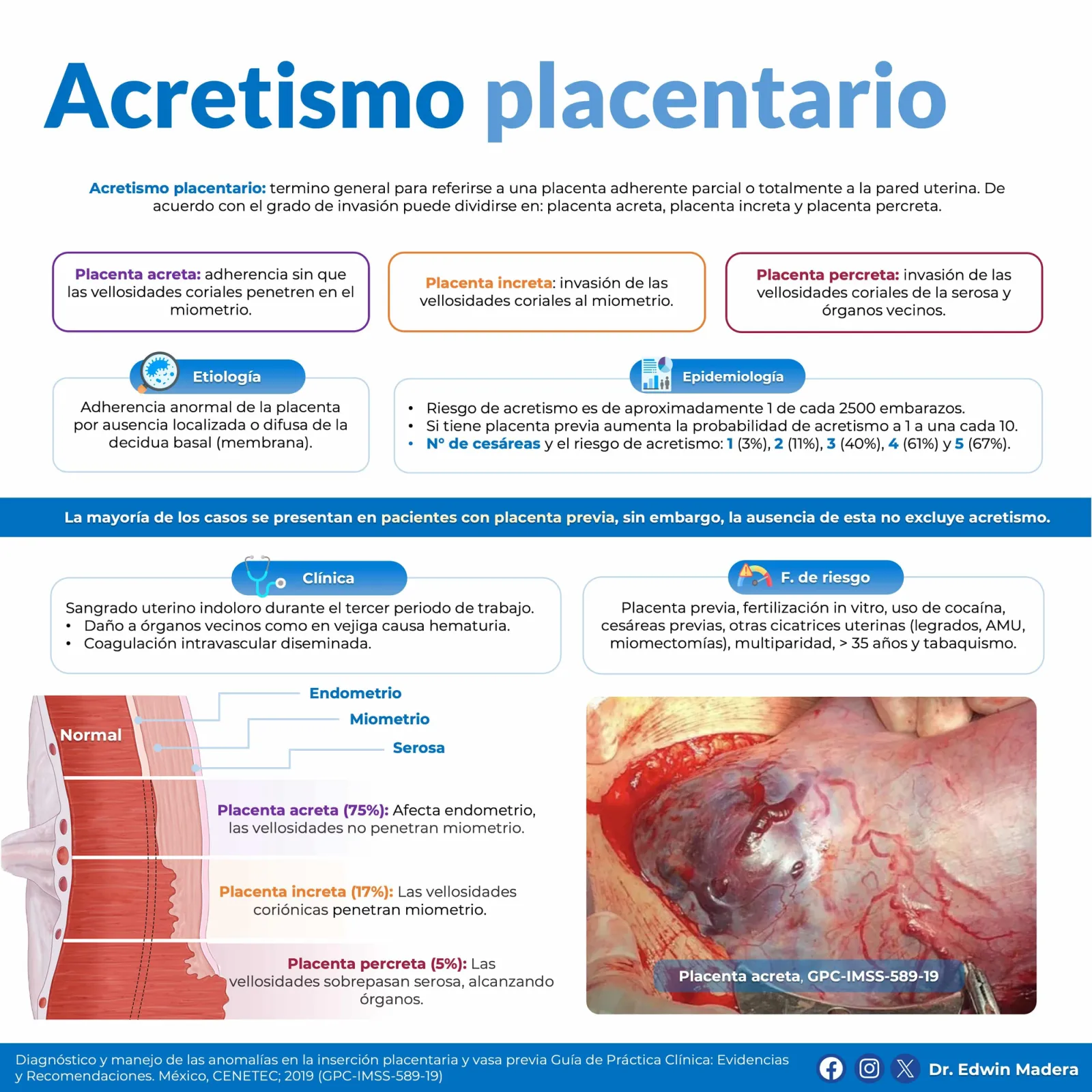 Acretismo placentario