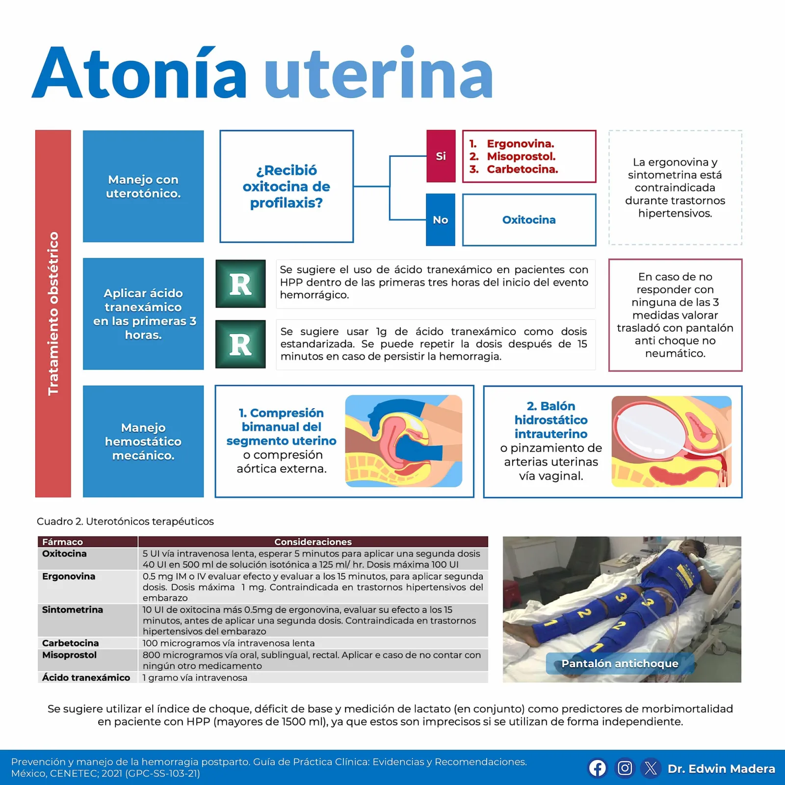 Atonía uterina