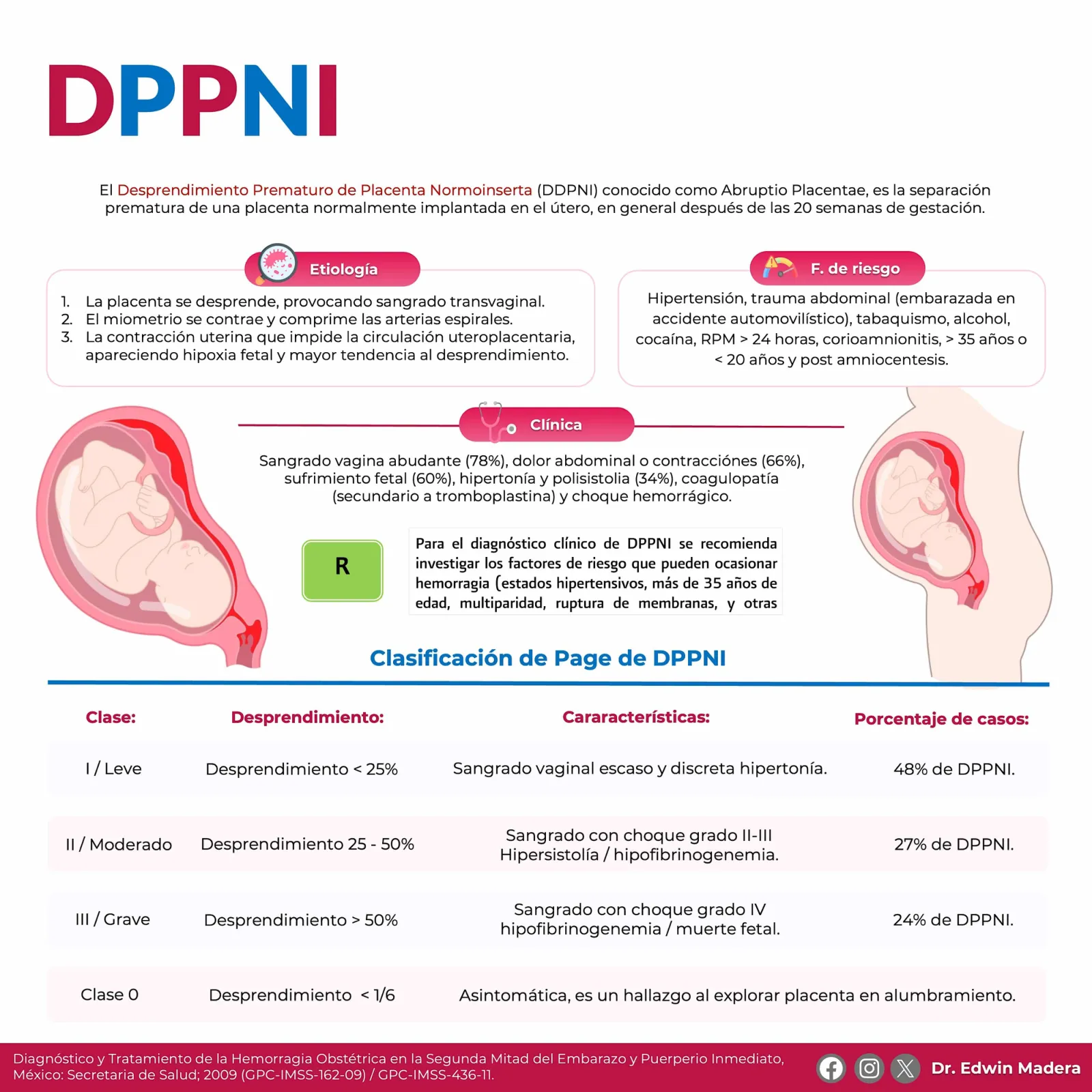 Desprendimiento prematuro de placenta normoinserta