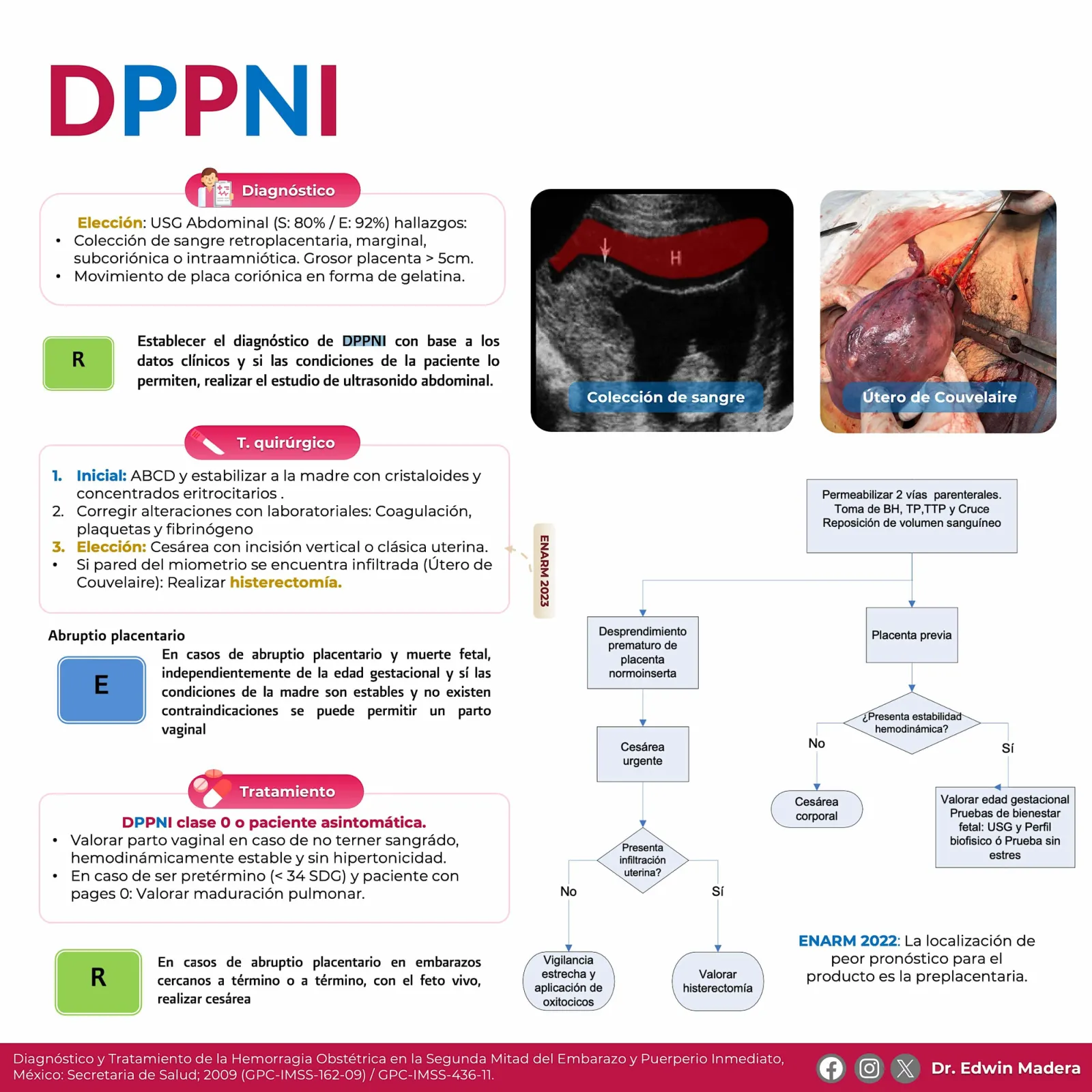Desprendimiento prematuro de placenta normoinserta