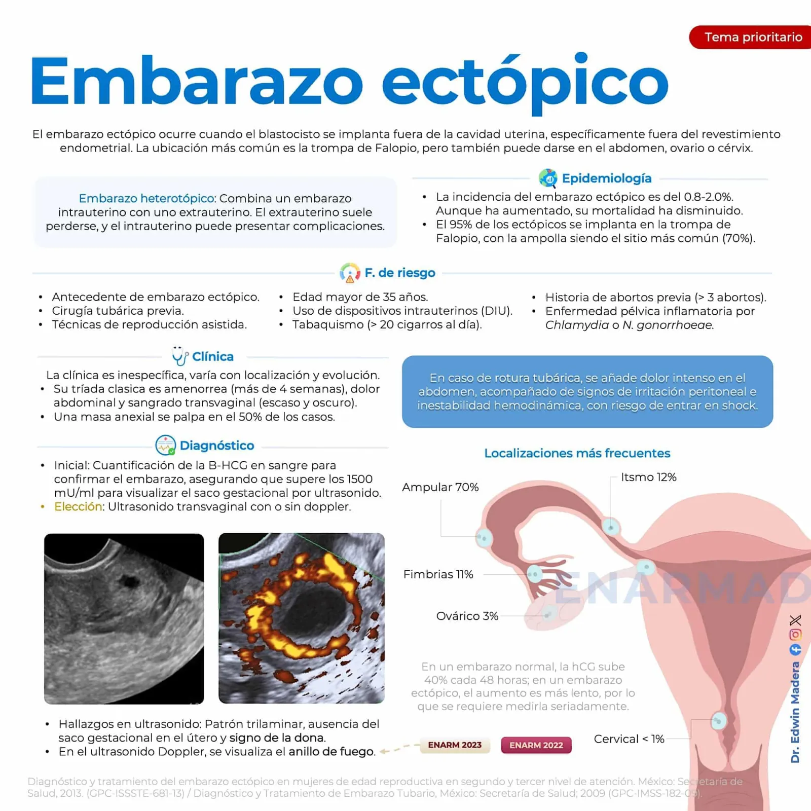 Embarazo ectópico
