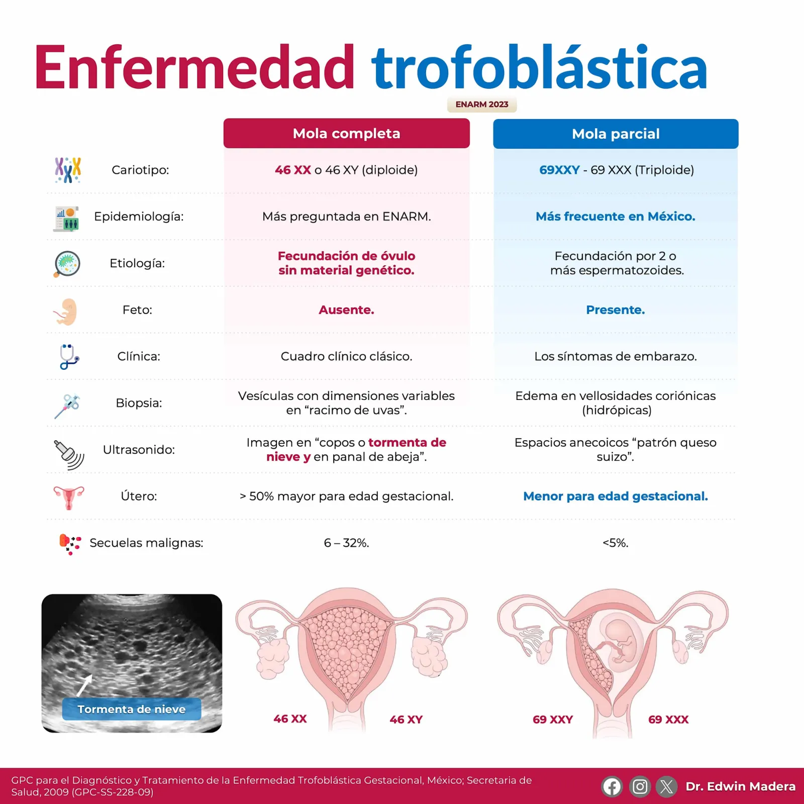 Enfermedad trofoblástica gestacional