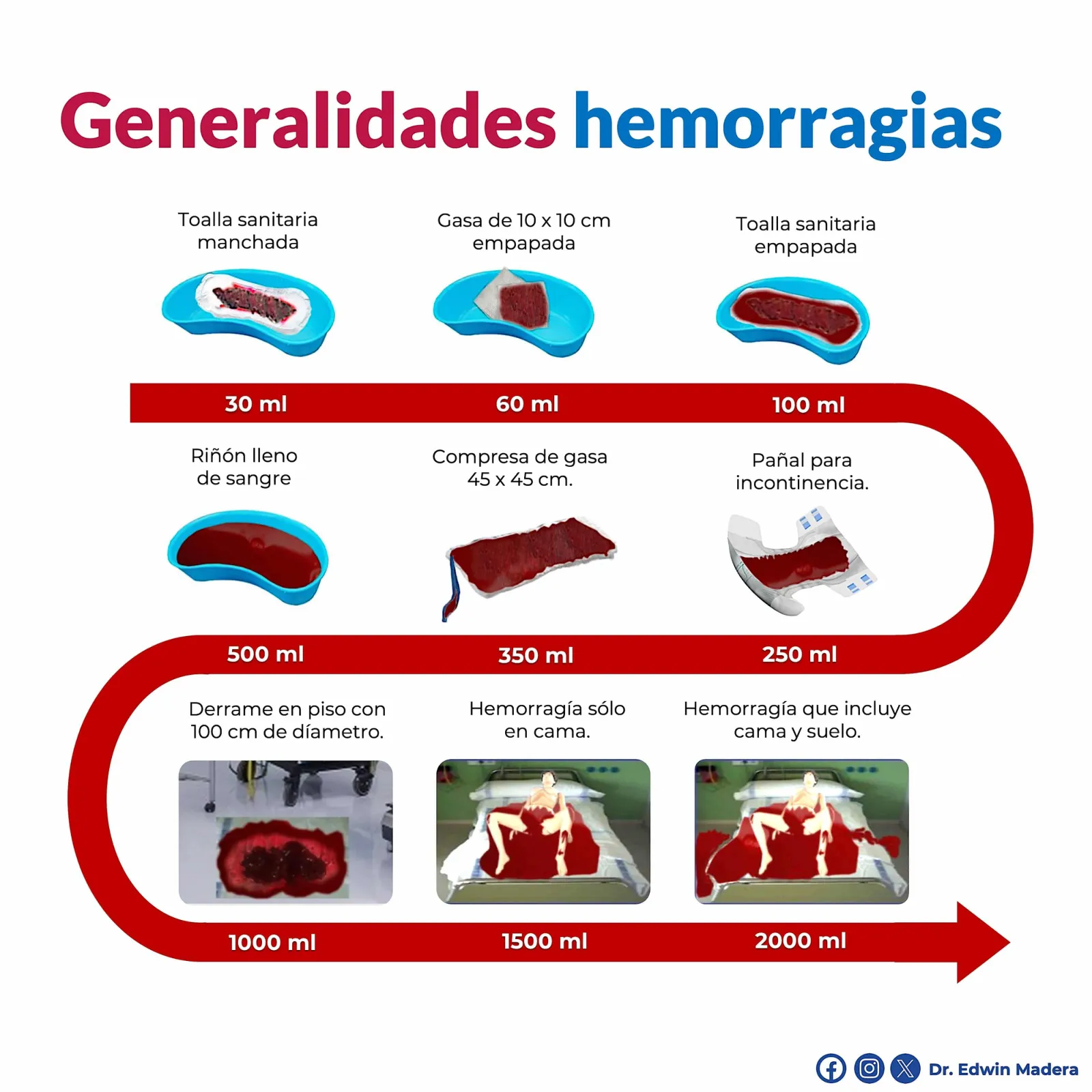 Generalidades de hemorrágias