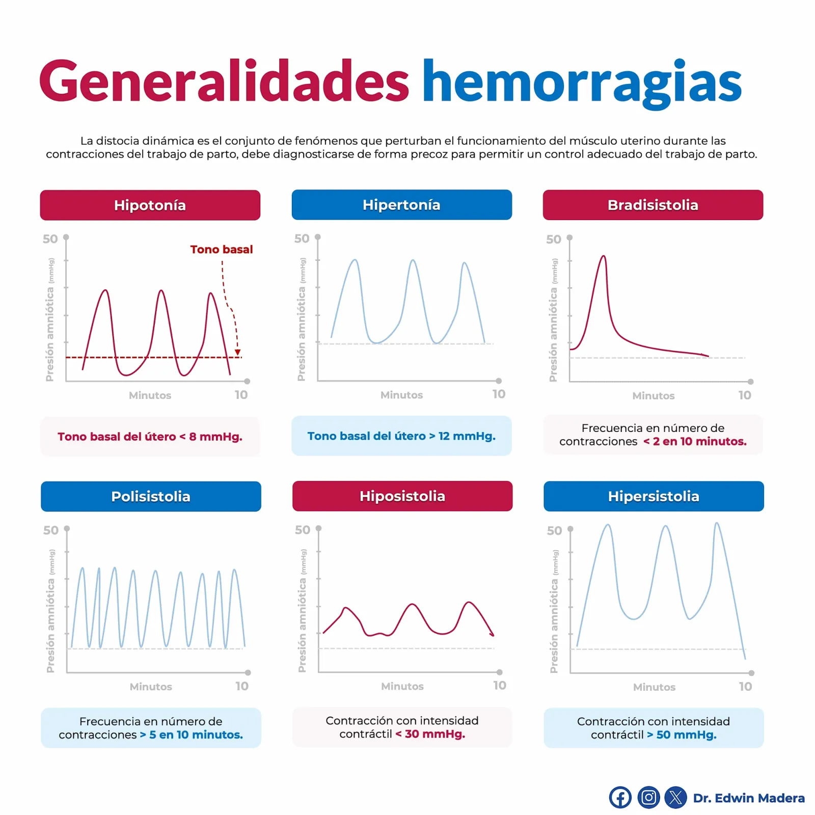 Generalidades de hemorragias