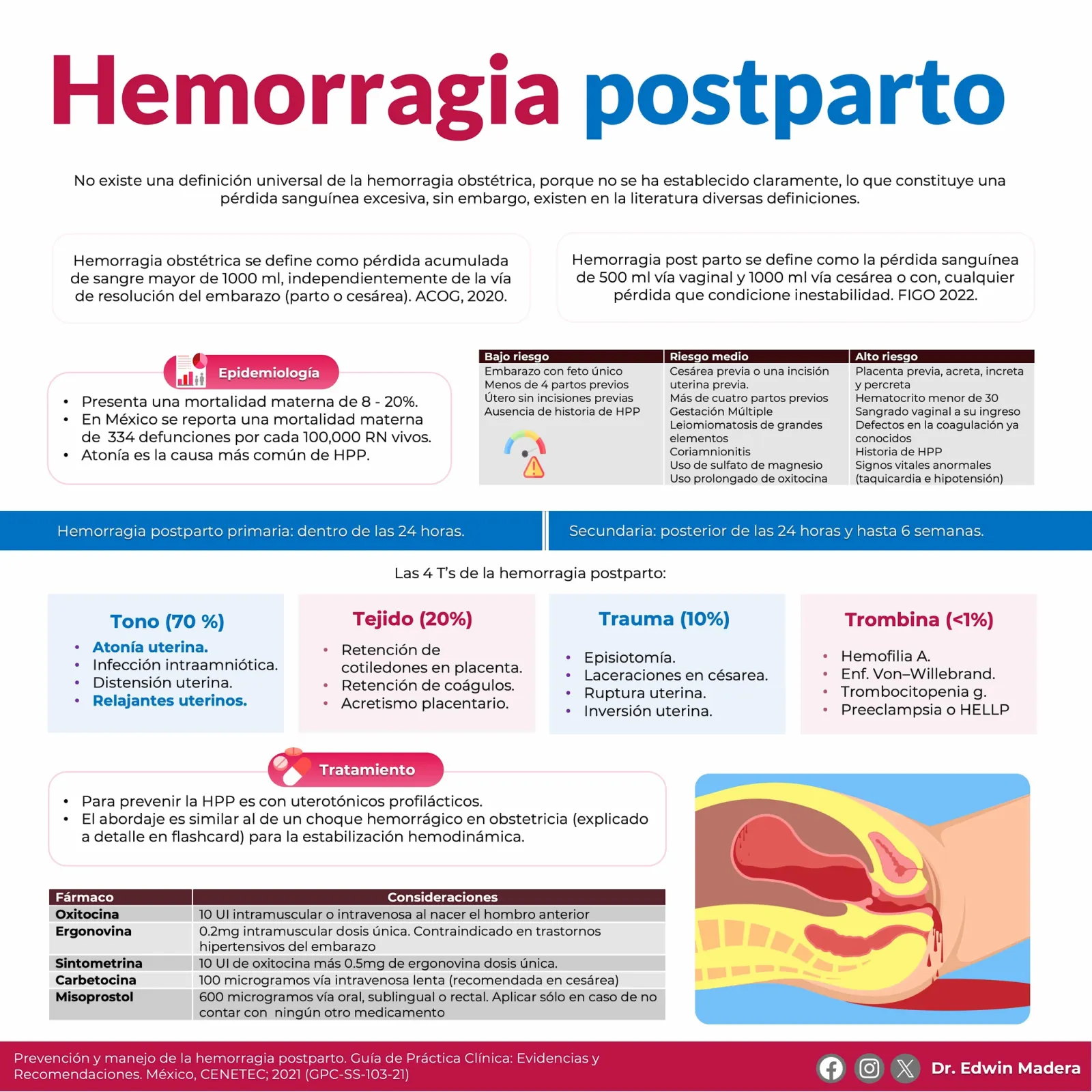 Hemorragia postparto