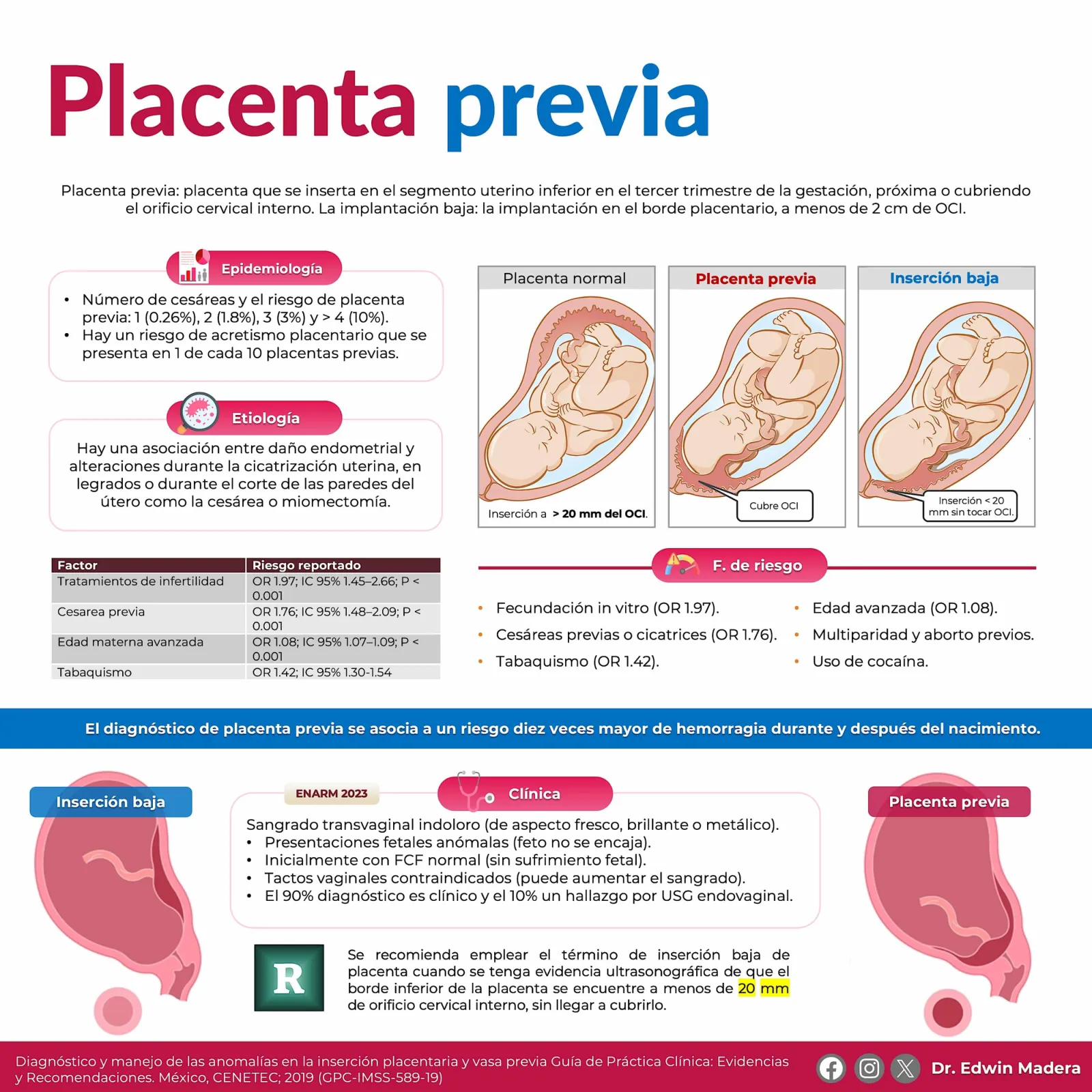 Placenta previa