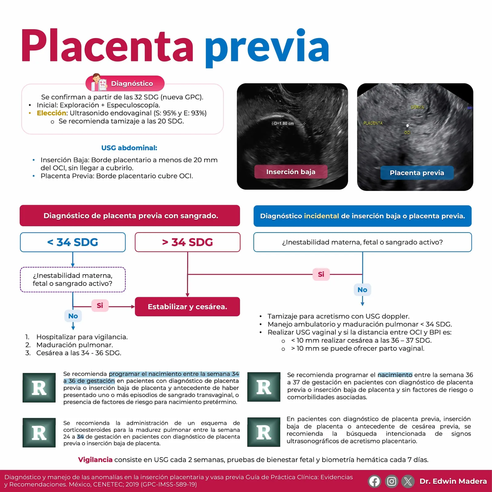 Placenta previa