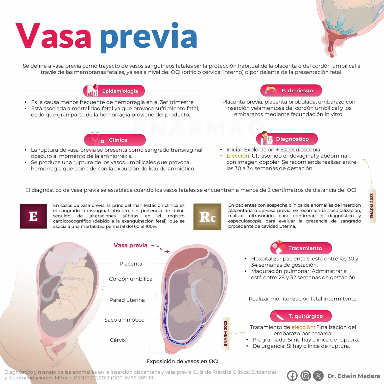 Vasa previa