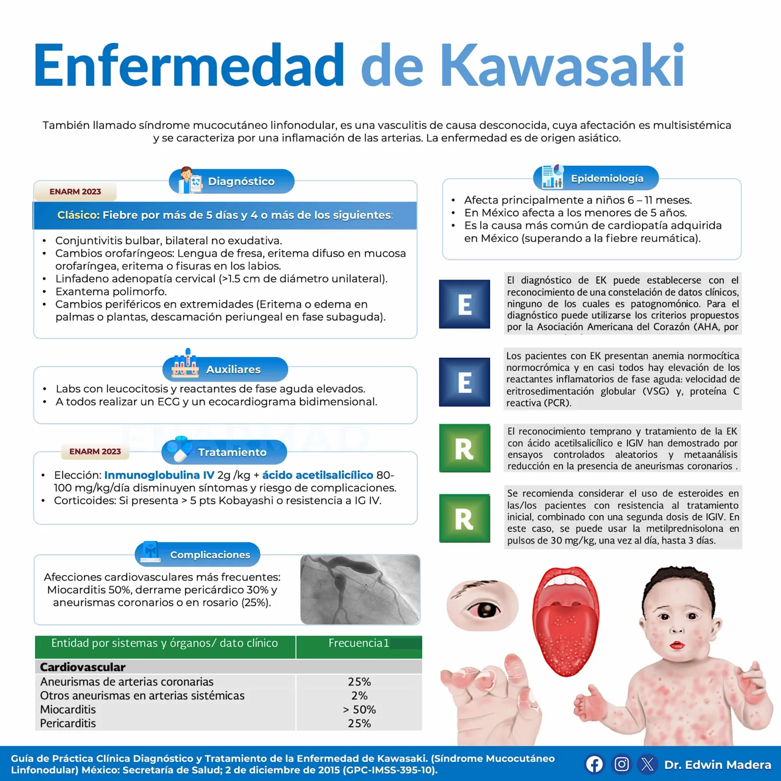 Enfermedad de Kawasaki