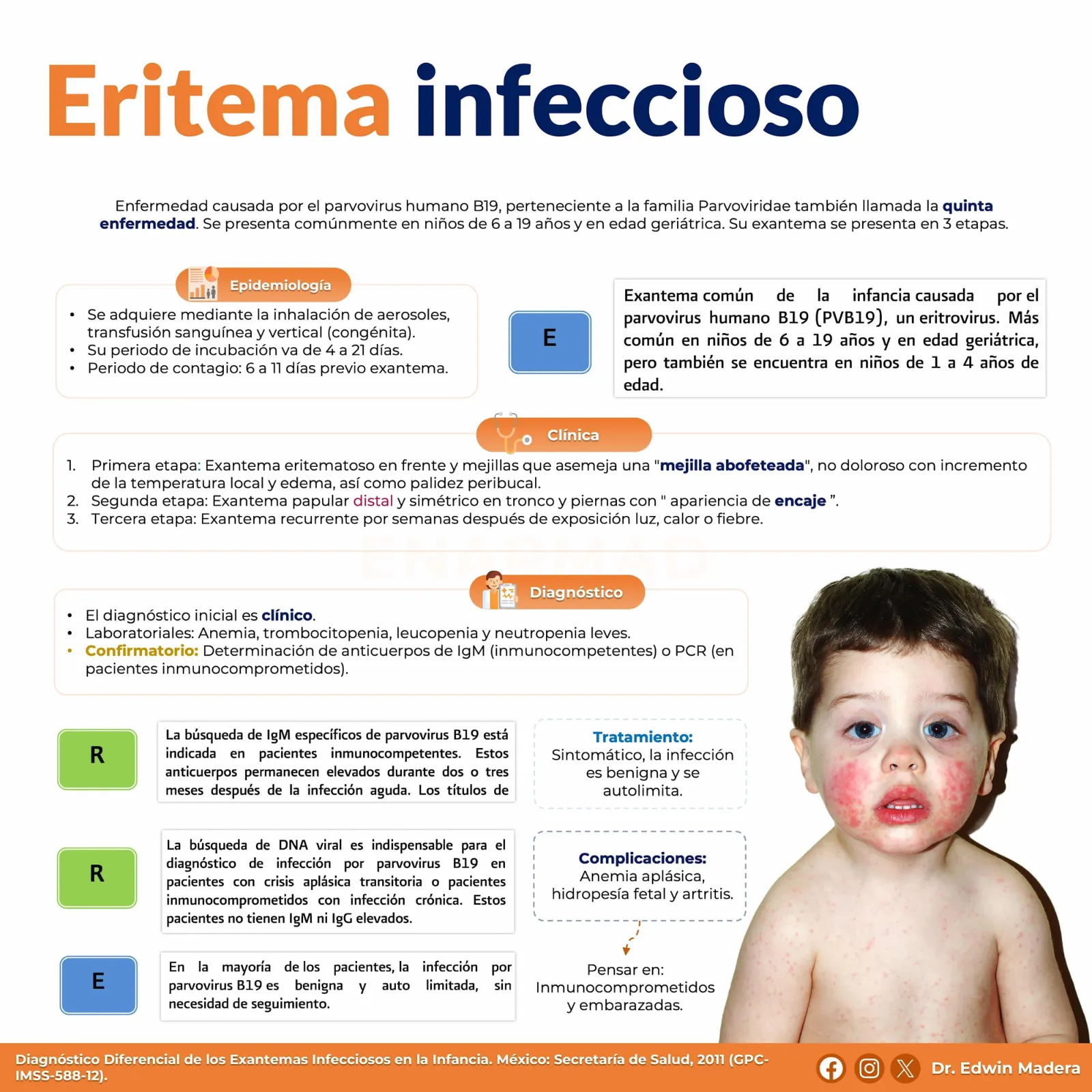 Eritema infeccioso