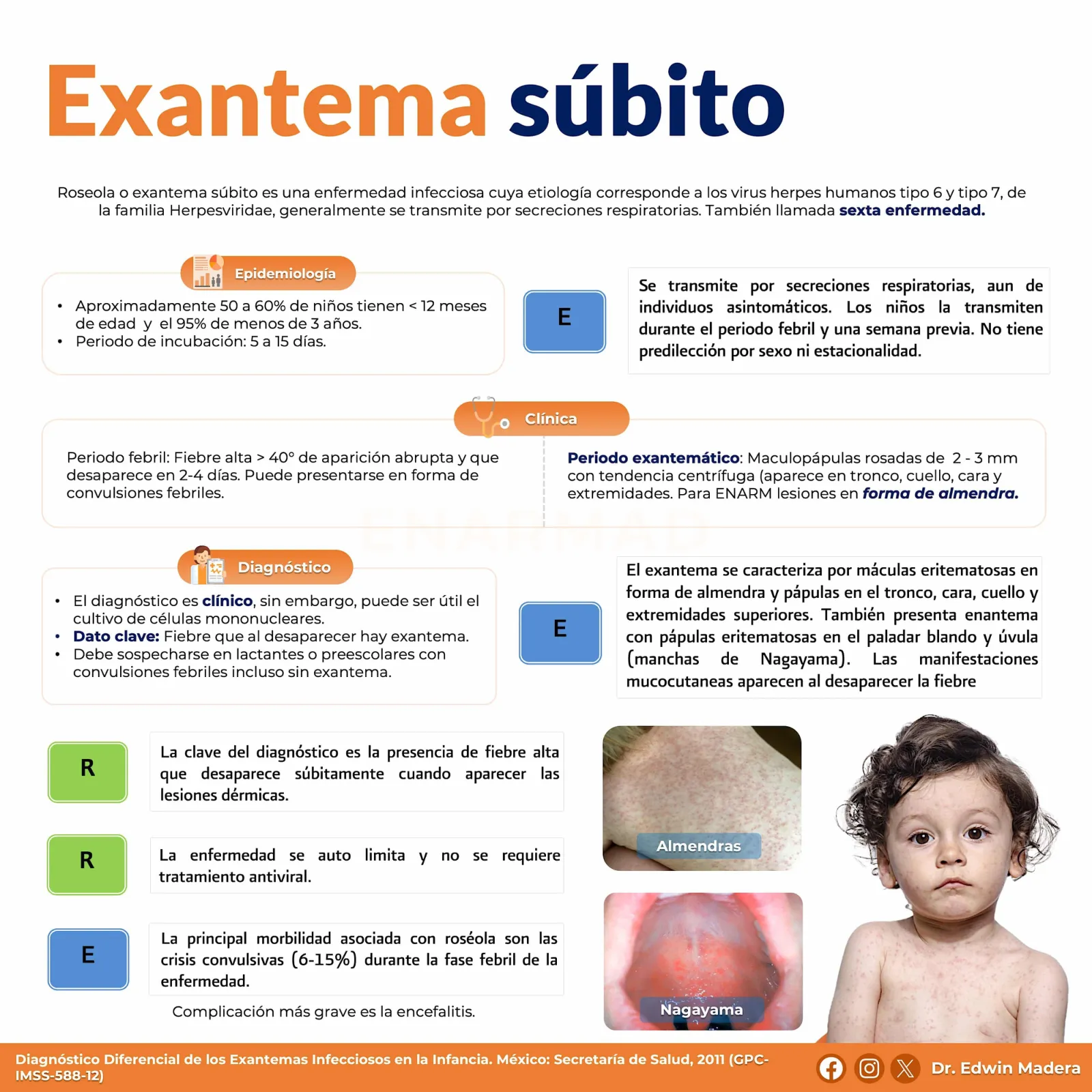Exantema súbito