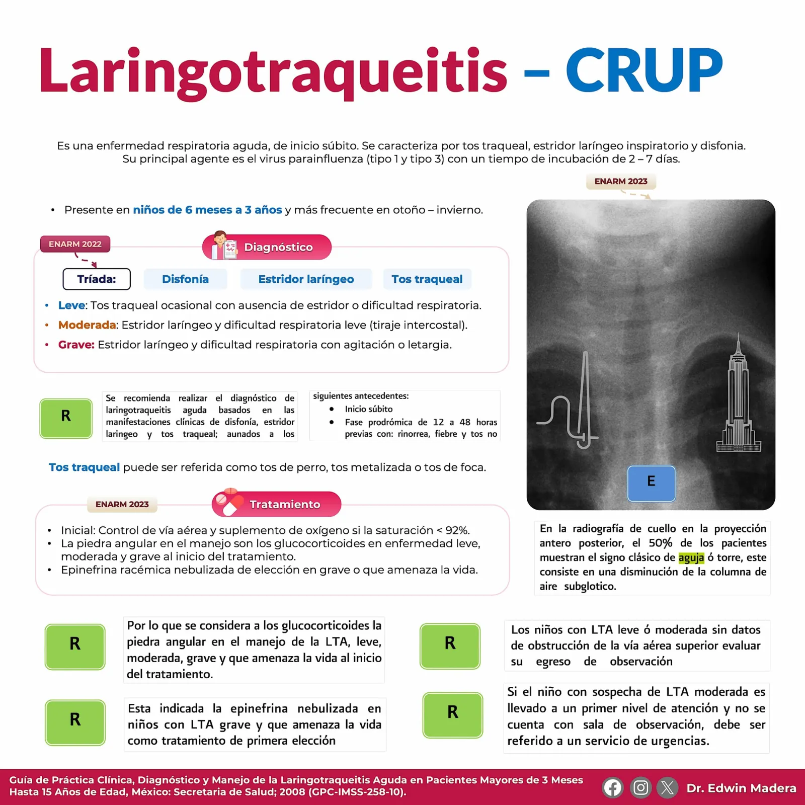 Larigotraqueitis CRUP