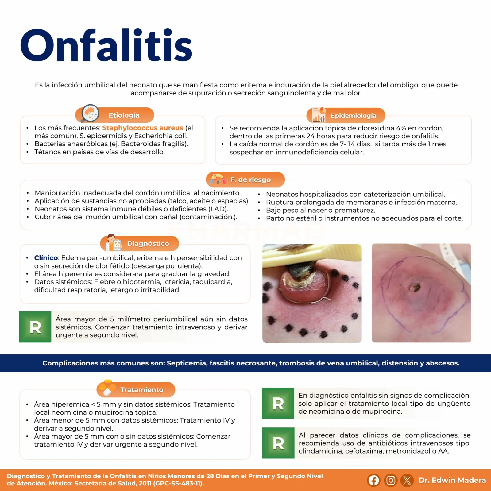 Onfalitis