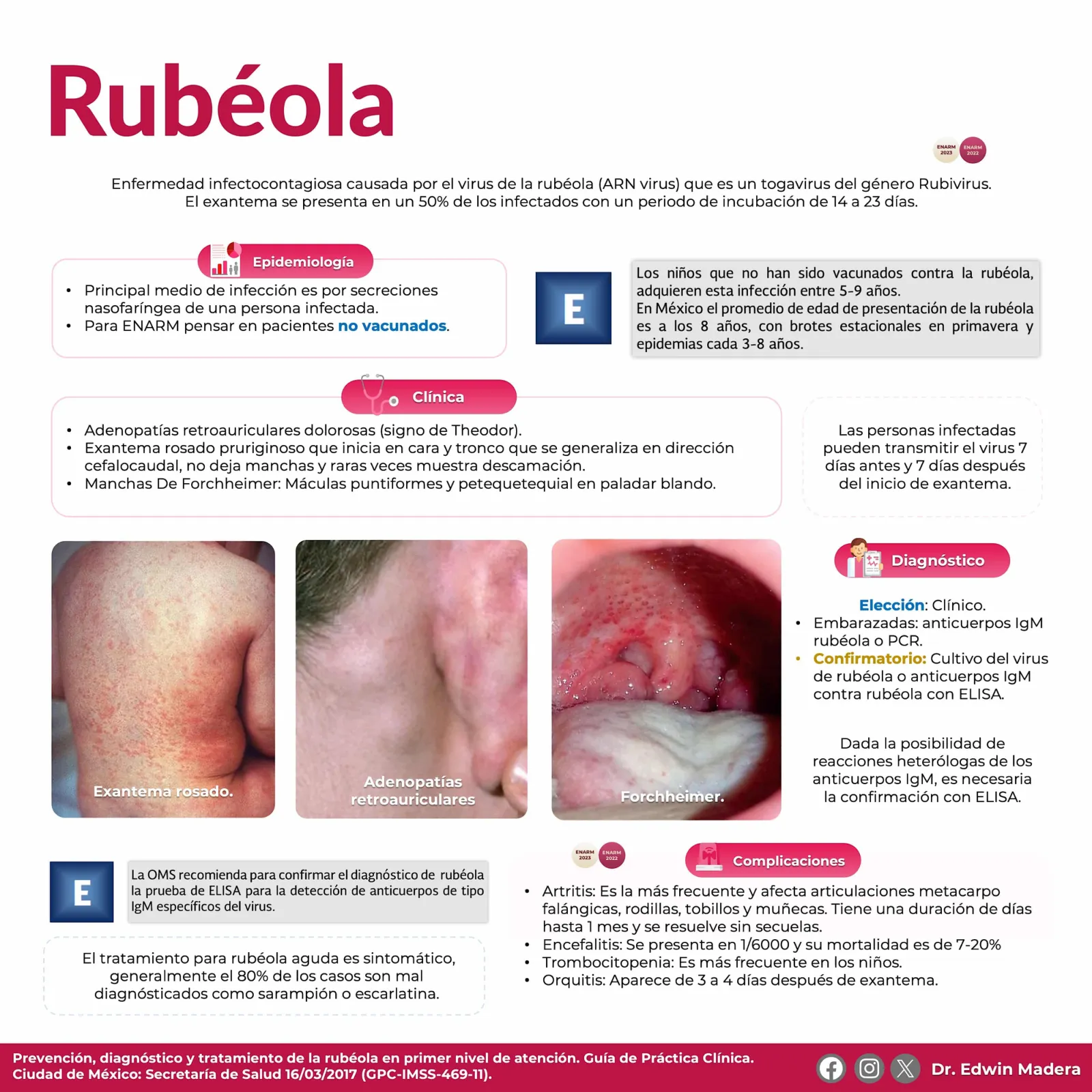 Rubéola