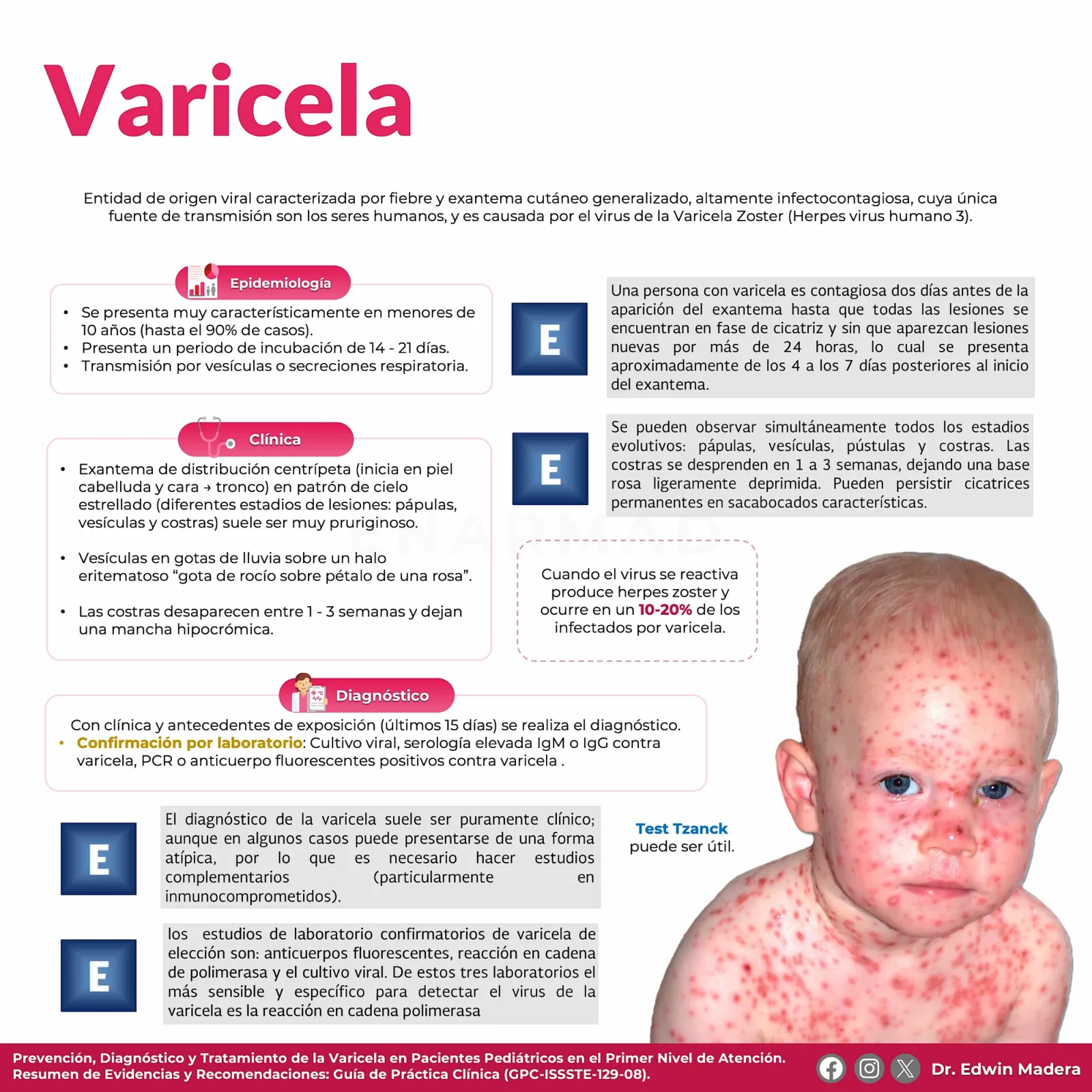 Varicela